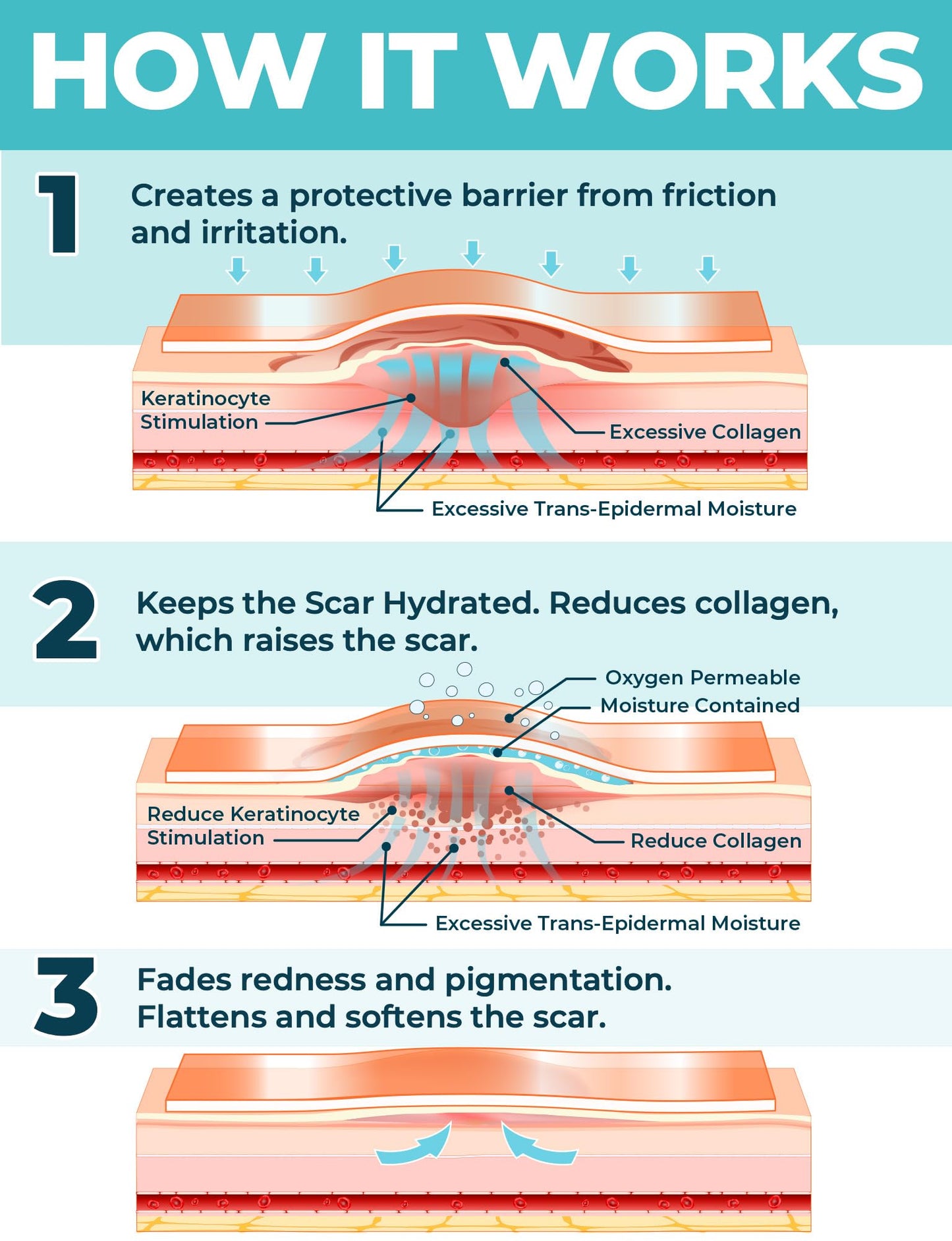 Medical Grade Silicone Scar Tape - 1.6”x70” - Effective Removal of Surgical, Keloid, C-Section, Tummy Tuck, Hypertrophic and Acne Scars - Easy to Use Treatment - Reusable Silicone Scar Sheets