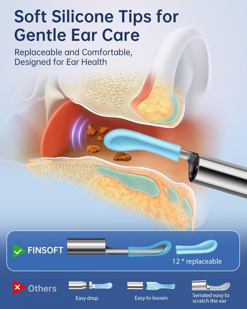 Ear Wax Removal Tool Camera, Ear Cleaner with Camera, Ear Wax Removal Cleaning Kit with 1296P HD Camera and 6 LED Lights, Earwax Removal Kit with 10 Ear Pick for iOS and Android, Navy Blue