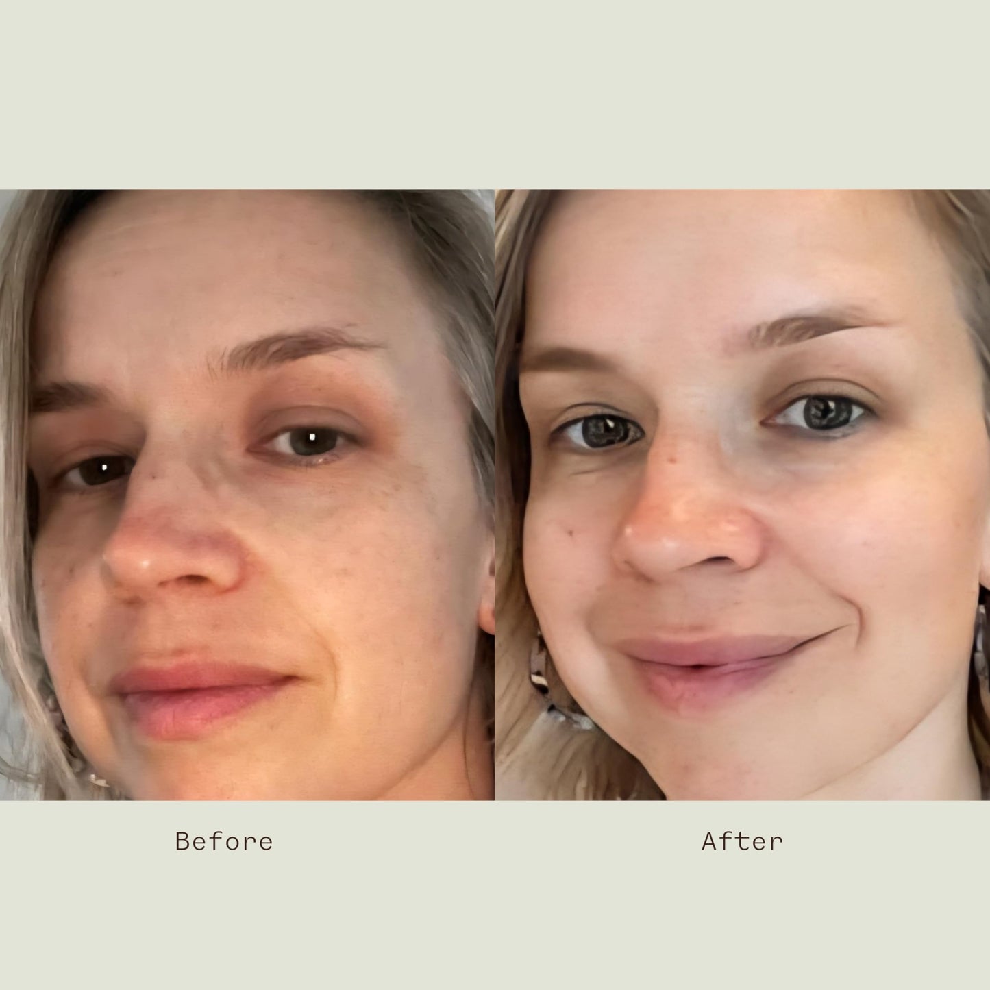 Matter of Monday Vitamin C Serum - Anti-Blue Light Brightening for Dark Spots & Uneven Skin Tone | Brightens & Smooths with Hyaluronic Acid & Antioxidants, Sensitive Skin Friendly, 1 fl oz