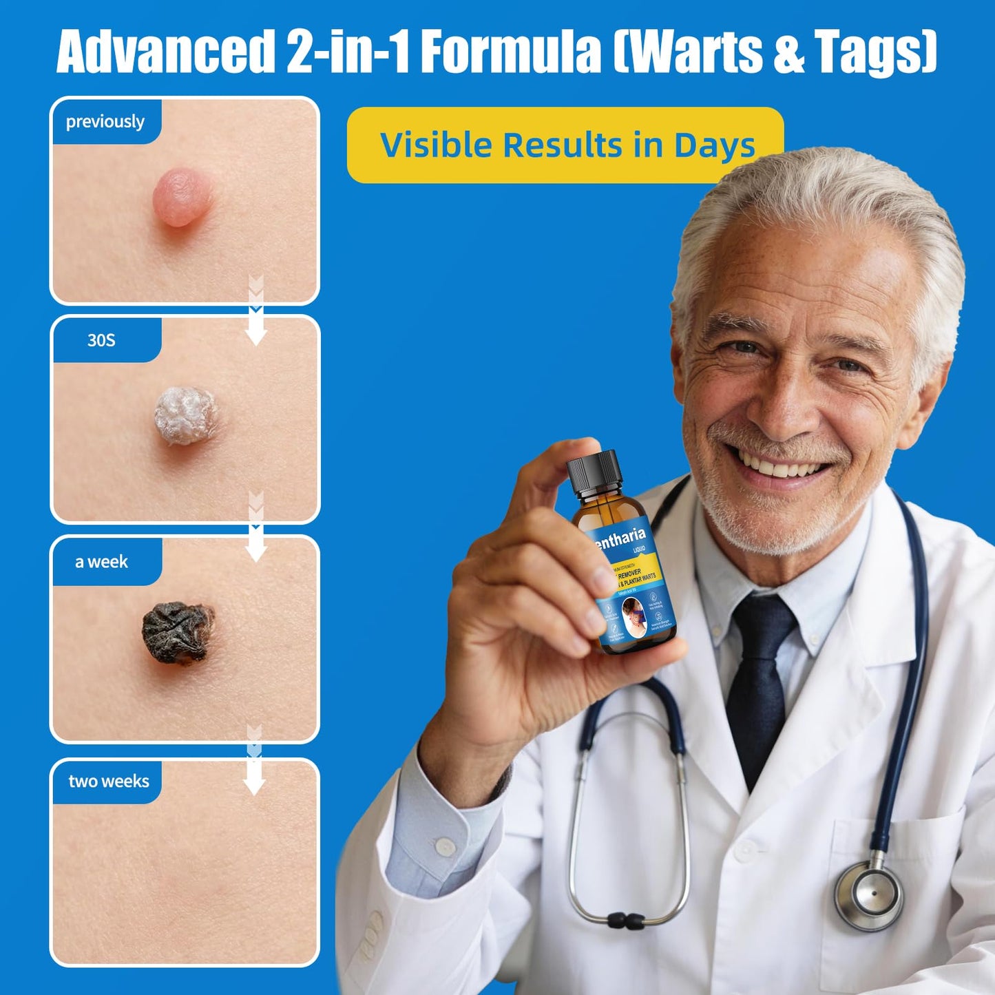 Glentharia Fast-Acting Skin Tag Remover, Wart Remover Freeze Off with Salicylic Acid Maximum Strength, Wart Removal for PlantarWart, GenitalWart, CommonWart, FlatWart, Callus