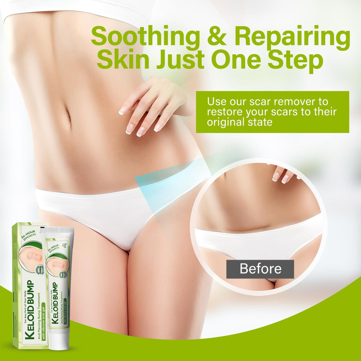 Keloid Bump Removal