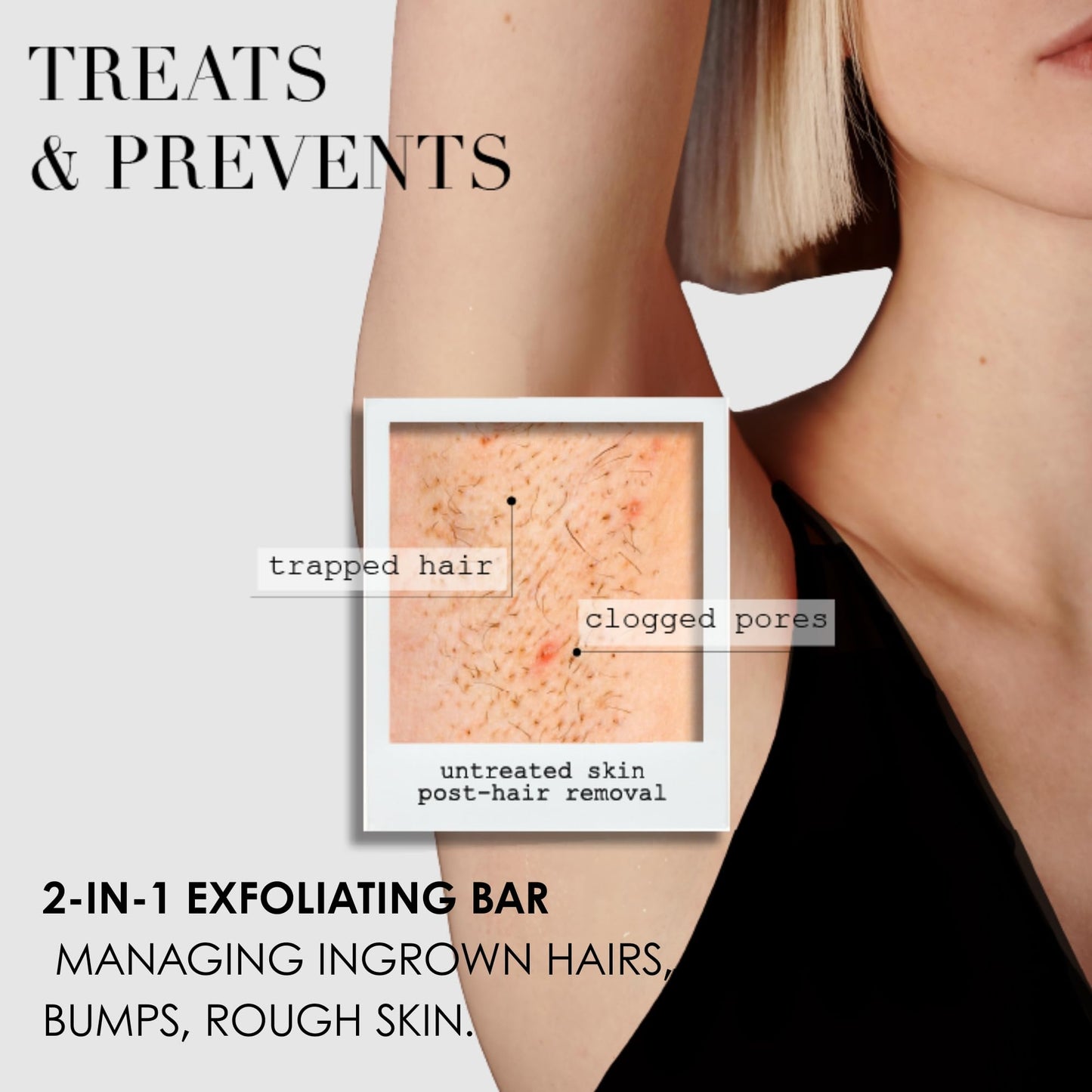 Kaia Naturals the takesumi bright® the ingrown bar – 5oz/140g, Exfoliating Bar Soap with Salicylic Acid and Tea Tree for Ingrown Hairs and Razor Bumps
