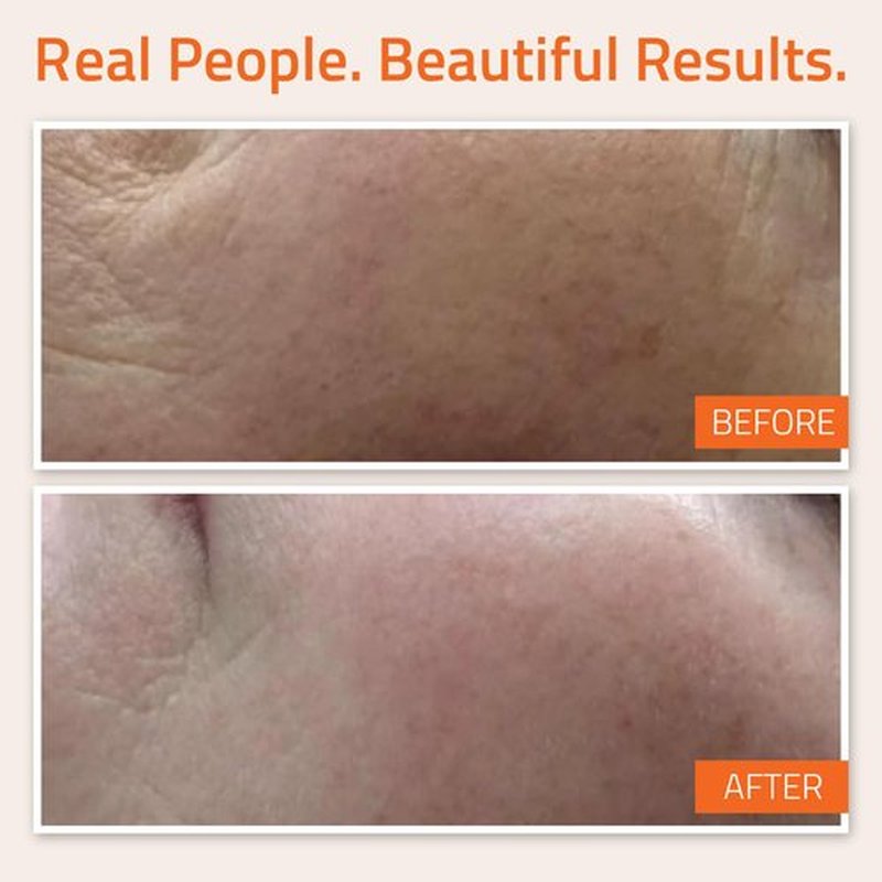 YEOUTH Vitamin C Face Serum with Hyaluronic Acid, Vitamin C Serum for Face, Vitamin C for Face Targets the Appearance of Dull Spots, Face Serum for Women and Men 2oz