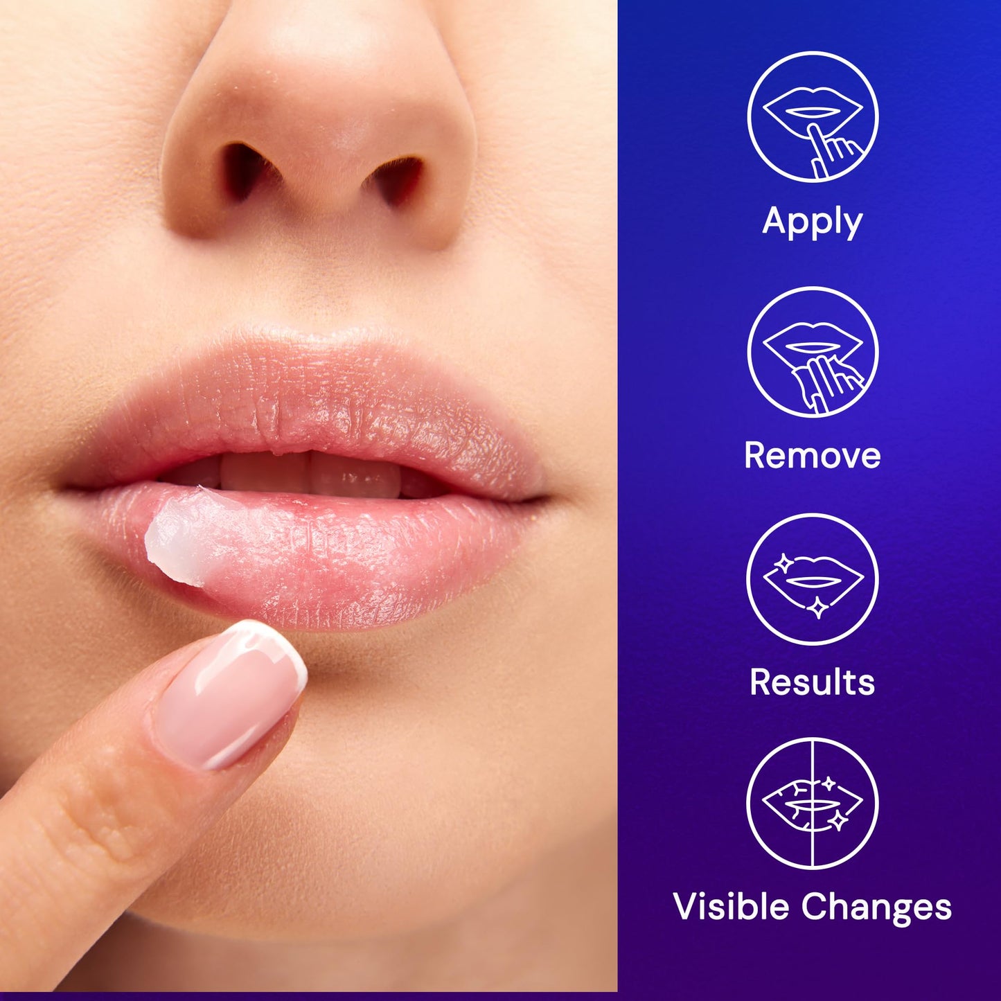 SNOW Overnight Lip Treatment - Moisturizing Lip Balm with Shea Butter & Vitamin E - Lip Treatment for Dry, Cracked Lips - Sulfate-Free Lip Treatment - Plumping & Hydrating Lip Care Mask