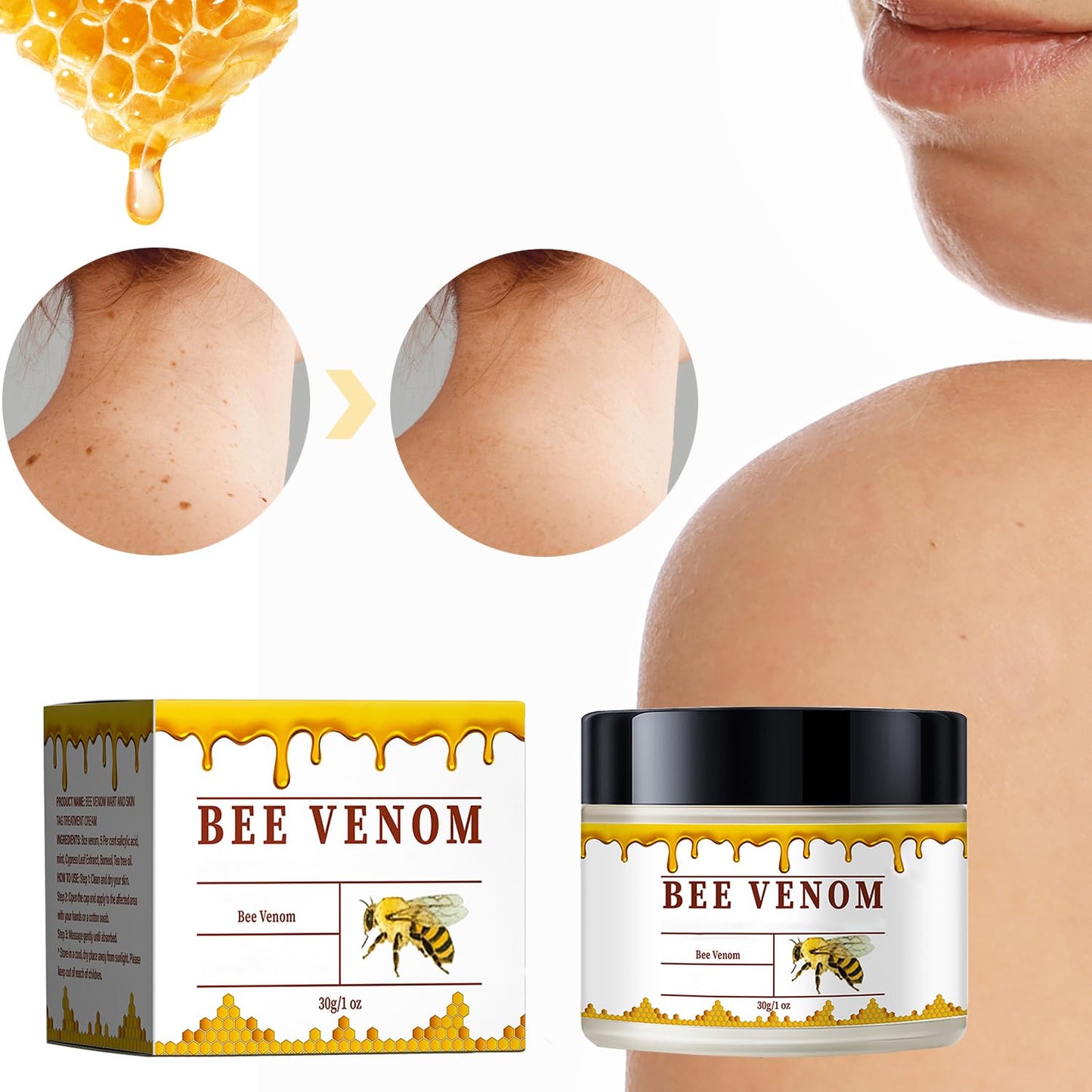 3 PCS Bee Venom Skin Treatment Cream, New Bee Venom Comprehensive Cream, Face lifting and firming, Natural Serum Suitable Gentle for All Skin Types