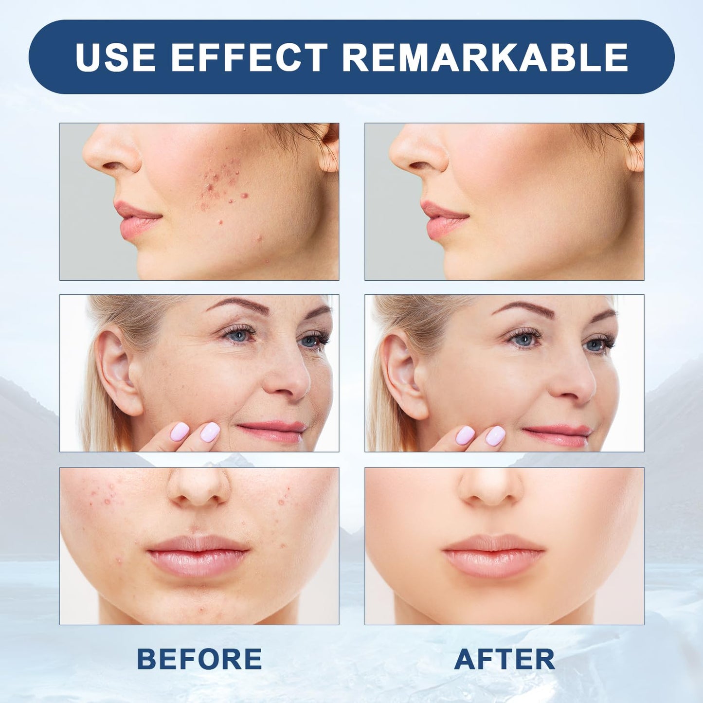 Facial Serum, Liquid Solution Anti Aging Serum, Promotes Skin Collagen Production, Diminishes Fine Lines & Wrinkles(2pcs)
