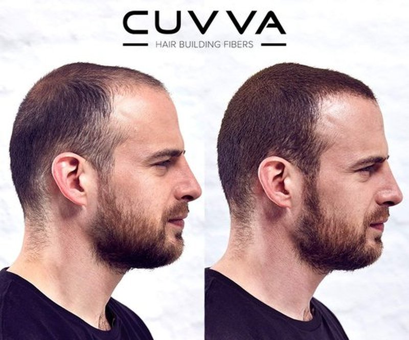 Hair Building Fibers by CUVVA for Fine & Thinning Hair (AUBURN) - Thicker Looking Hair in 15 Seconds - 10 Different Shades for Men & Women - 0.87oz