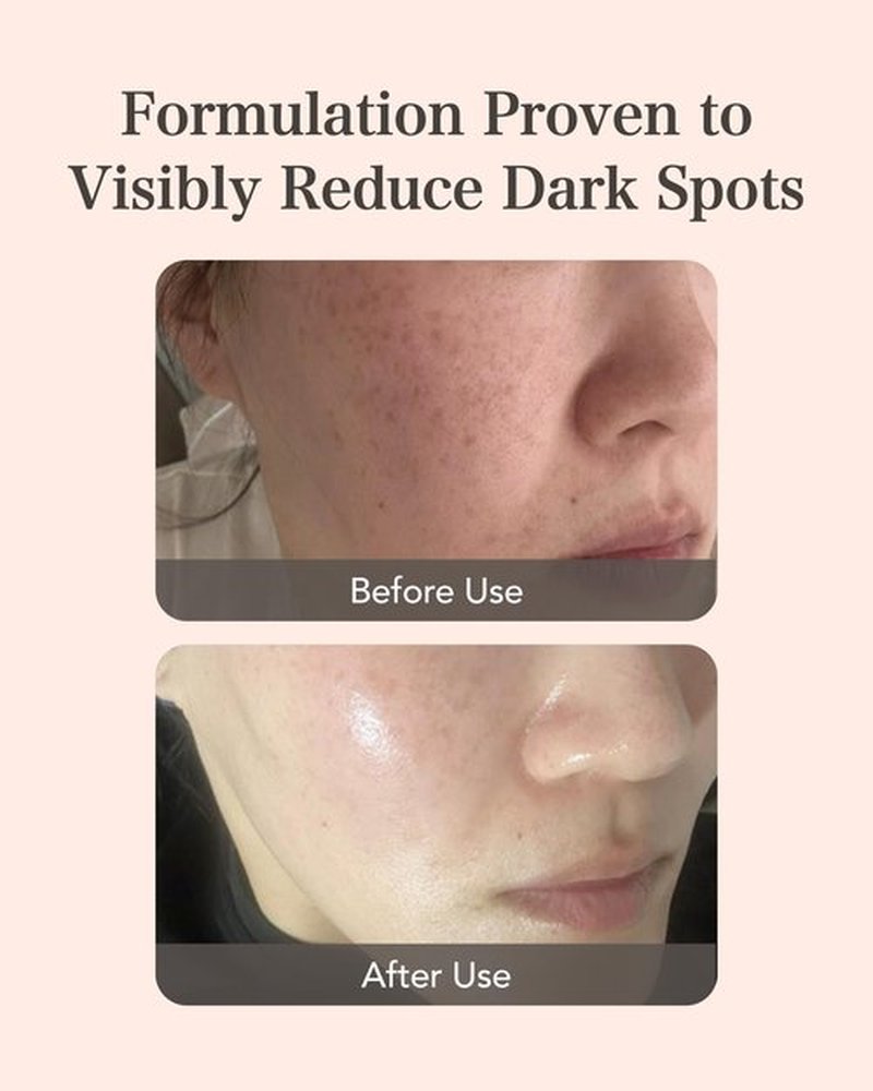 MASTINA Mastic Ampoule Serum Spoid Type Set(Dropper Type, 0.5fl oz, pack of 3) - Serum for Even Skin Tone and Elasticity. Fermented Mastic Gum