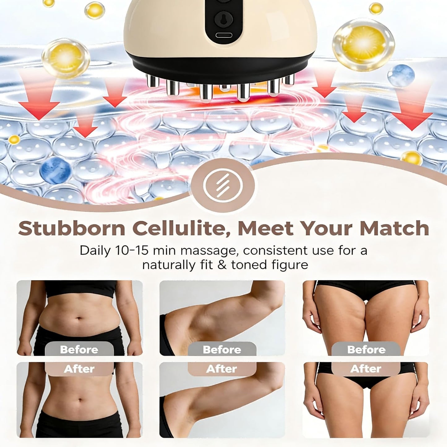 ShuSinki Lymphatic Drainage Massager & Anti Cellulite Massage Tool, Helps Reduce Stretch Marks & Cellulite, for Legs, Arms & Belly, Body Sculpting Machine with Microcurrent, Light, Heat & Vibration