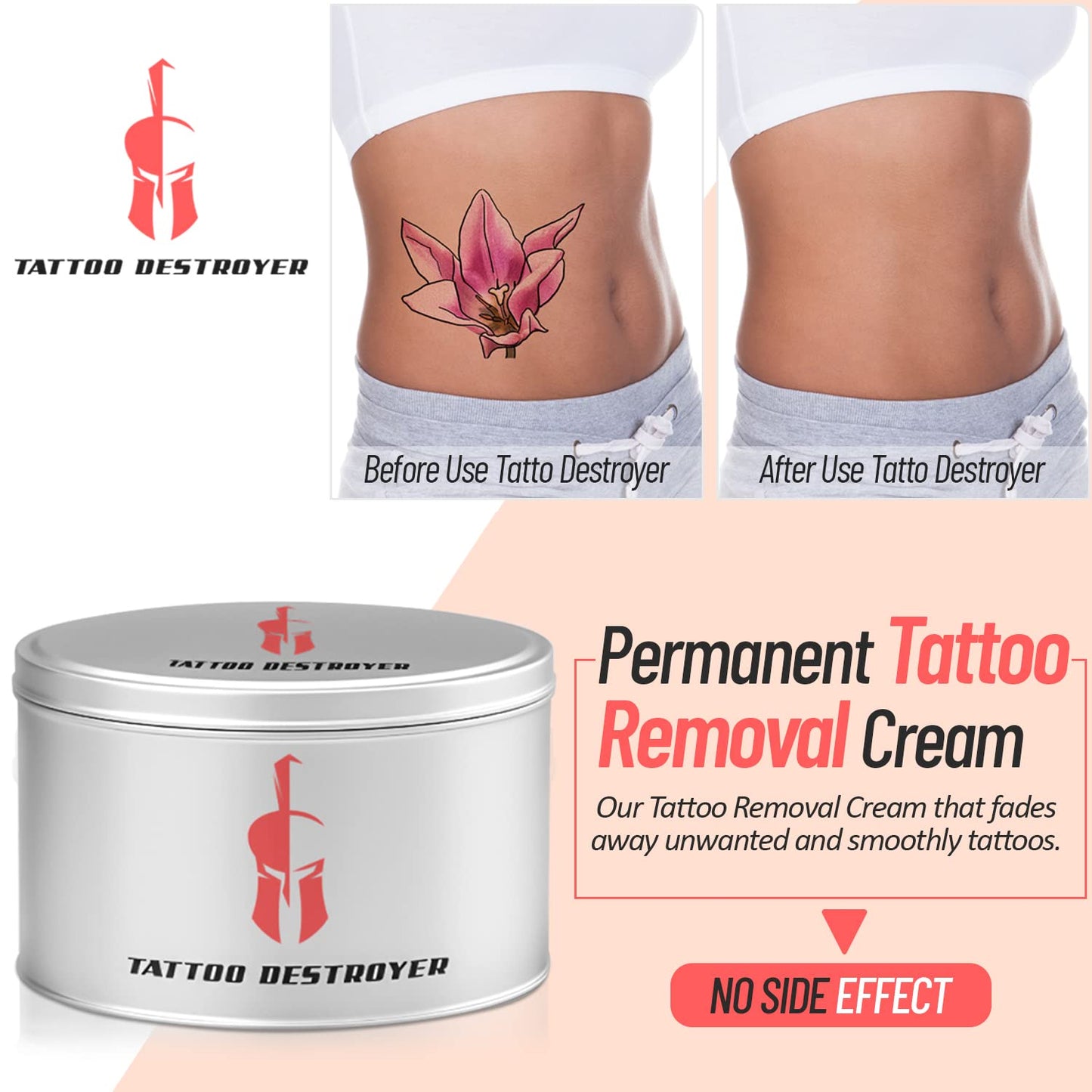Tattoo Removal Cream 2 month spartan perform
