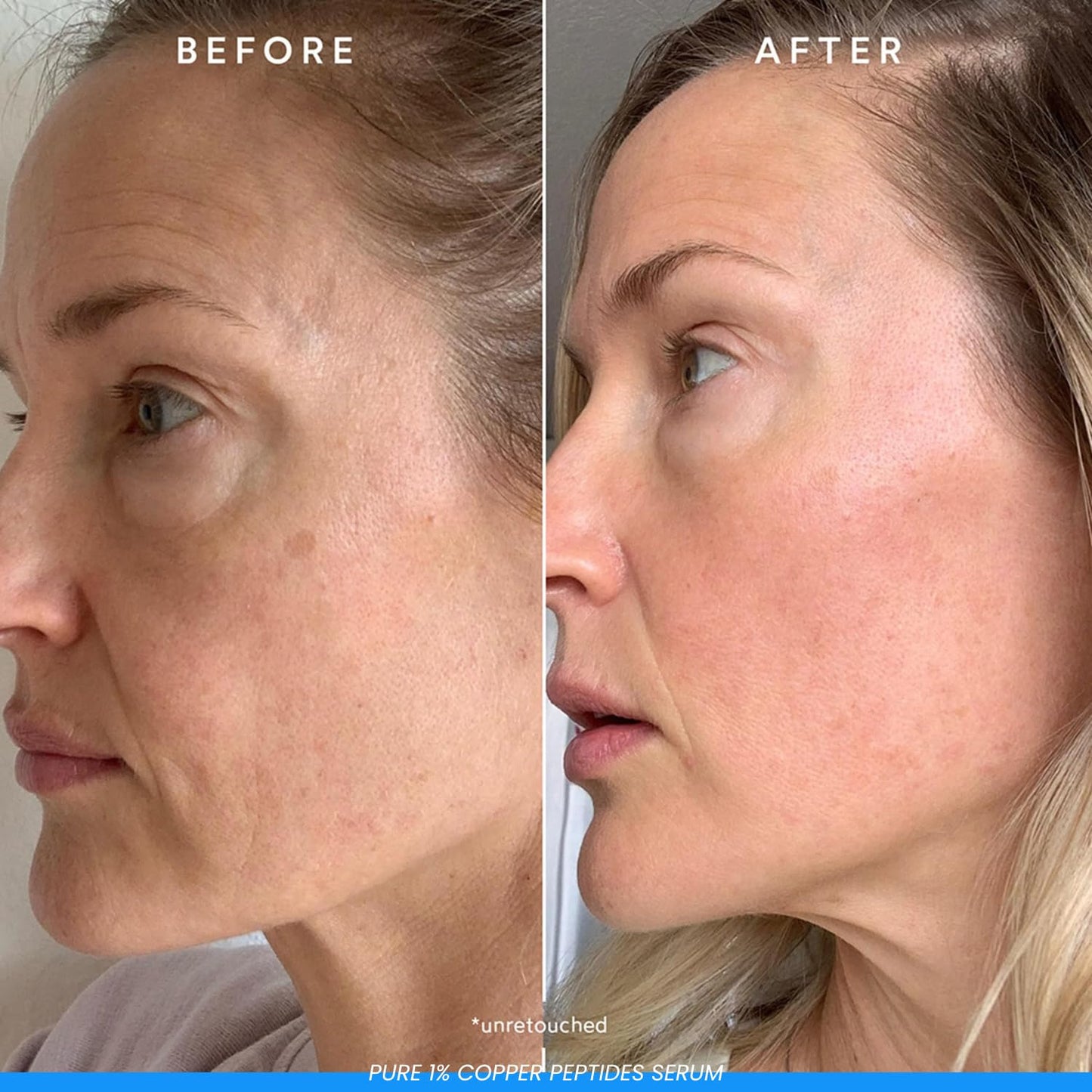 The Youthful - Copper Peptide Face Serum Collagen (Formula Same Buffet Plus Copper Peptides) Peptide Serum for Hydration, Anti-Aging, Firmness, Skin Elasticity, Copper Elixir - 30ML