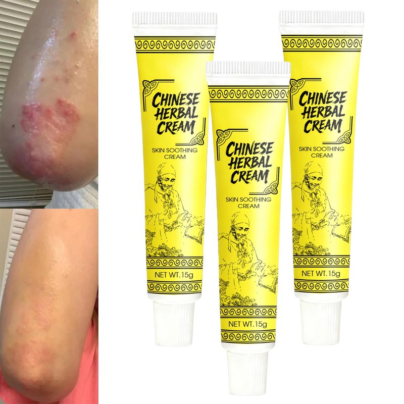 Smiles and Joys Herbal Cream, East Asian Natural Herbal Cream, Herbals Ointment for Natural Relief of Skin Problems for All Skin Types