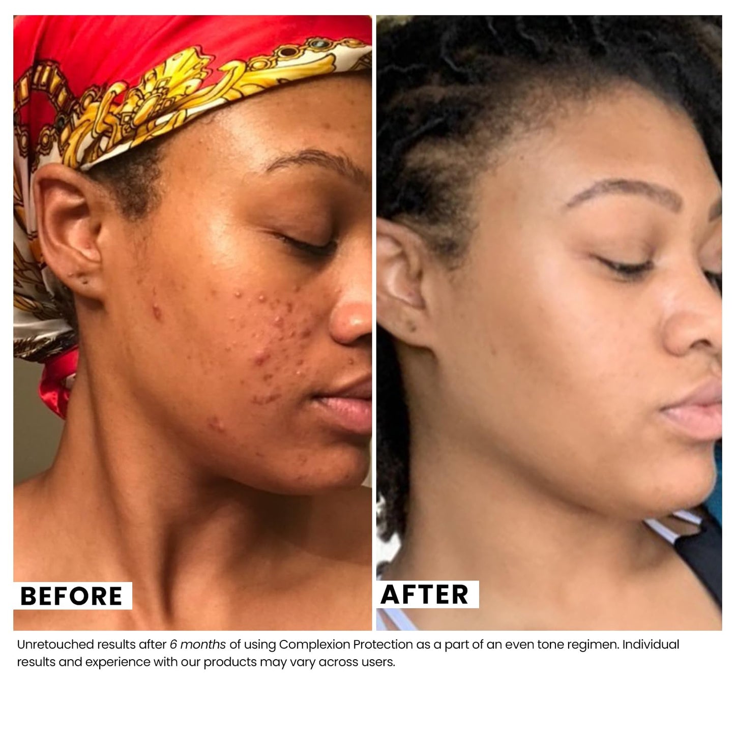 Urban Skin Rx® Complexion Protection Even Tone SPF30 Moisturizer, Sheer, Lightweight, Non-Pore Clogging Cream Hydrates & Provides Sun Protection, With Squalane, Hyaluronic Acid & Vitamin E, 1.7 Oz