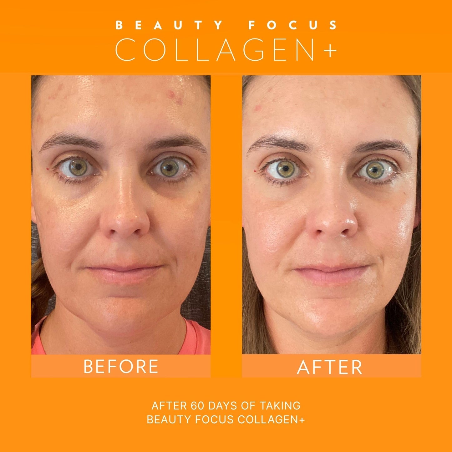 Nu Skin Beauty Focus Collagen + | 30 Pouches | Strawberry Flavored