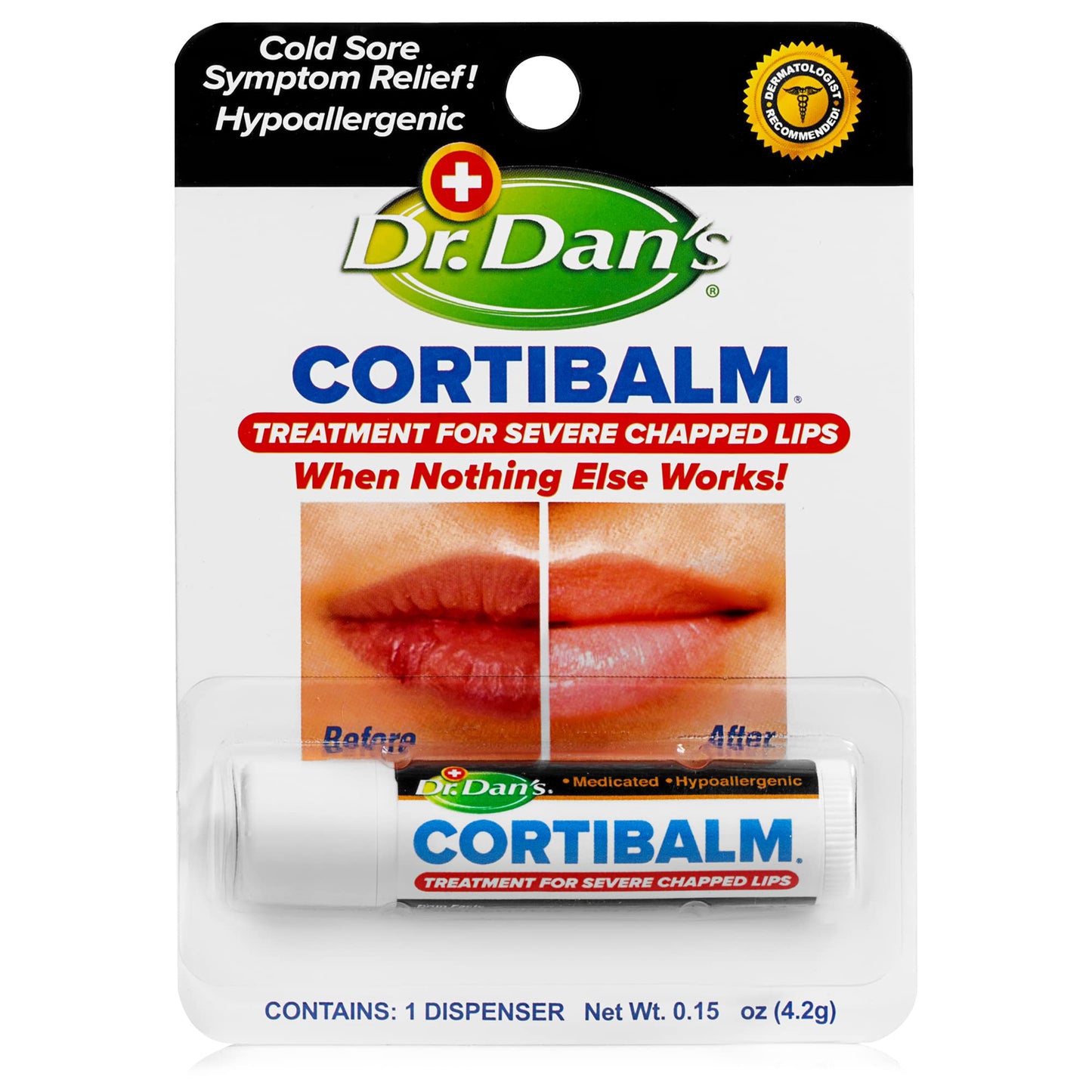 Dr. Dan’s Cortibalm - Medicated Lip Balm with Hydrocortisone – Healing Treatment & Moisturizer for Severely Chapped, Very Dry Cracked Lips – 1 Pack