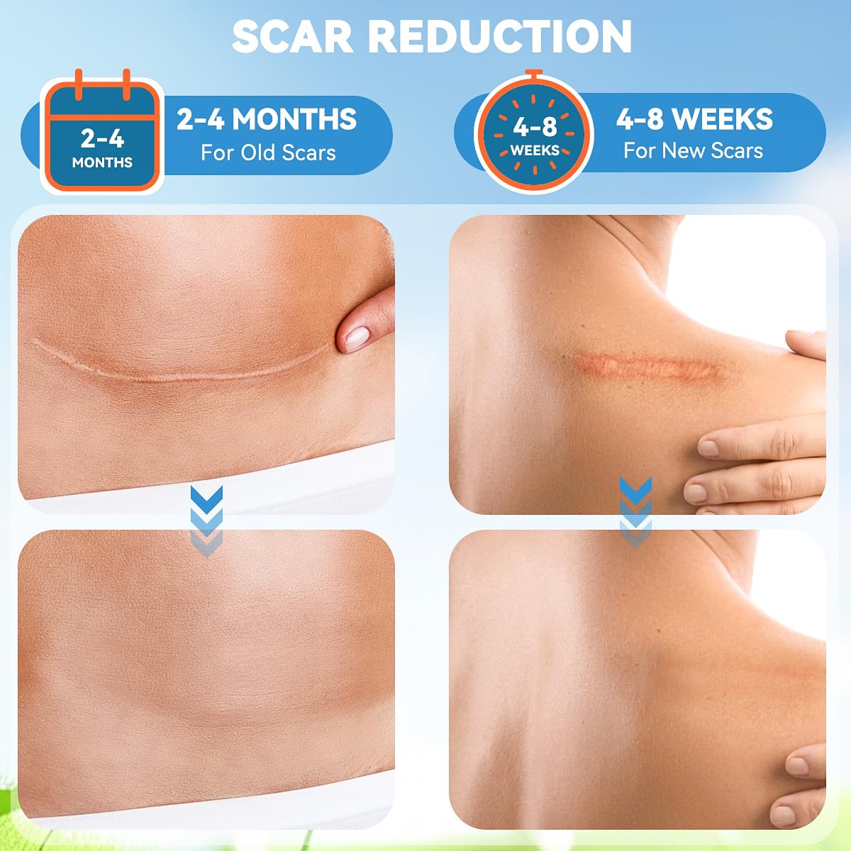Silicone Scar Sheets Face Tape: 1.6''x120'' Scar Tape for Surgical Scars - Medical Grade Wrinkles Patches -Reusable Strips Scar Removal Treatment C-Section Keloid Burn Tummy Acne (1.6‘’x120'')