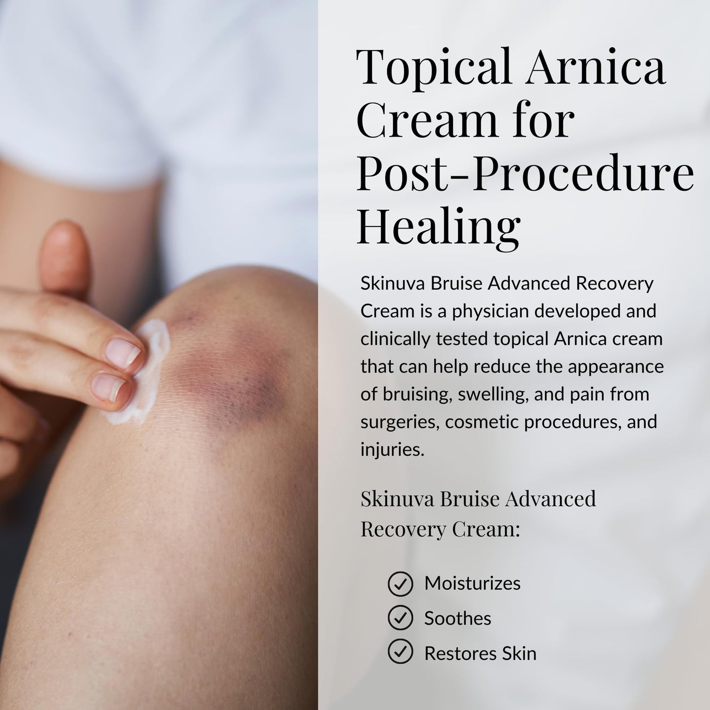 Skinuva® Bruise Advanced Recovery Cream - Topical Bruise Cream Formulated with Growth Factors, Arnica & Vitamin K (1 oz)