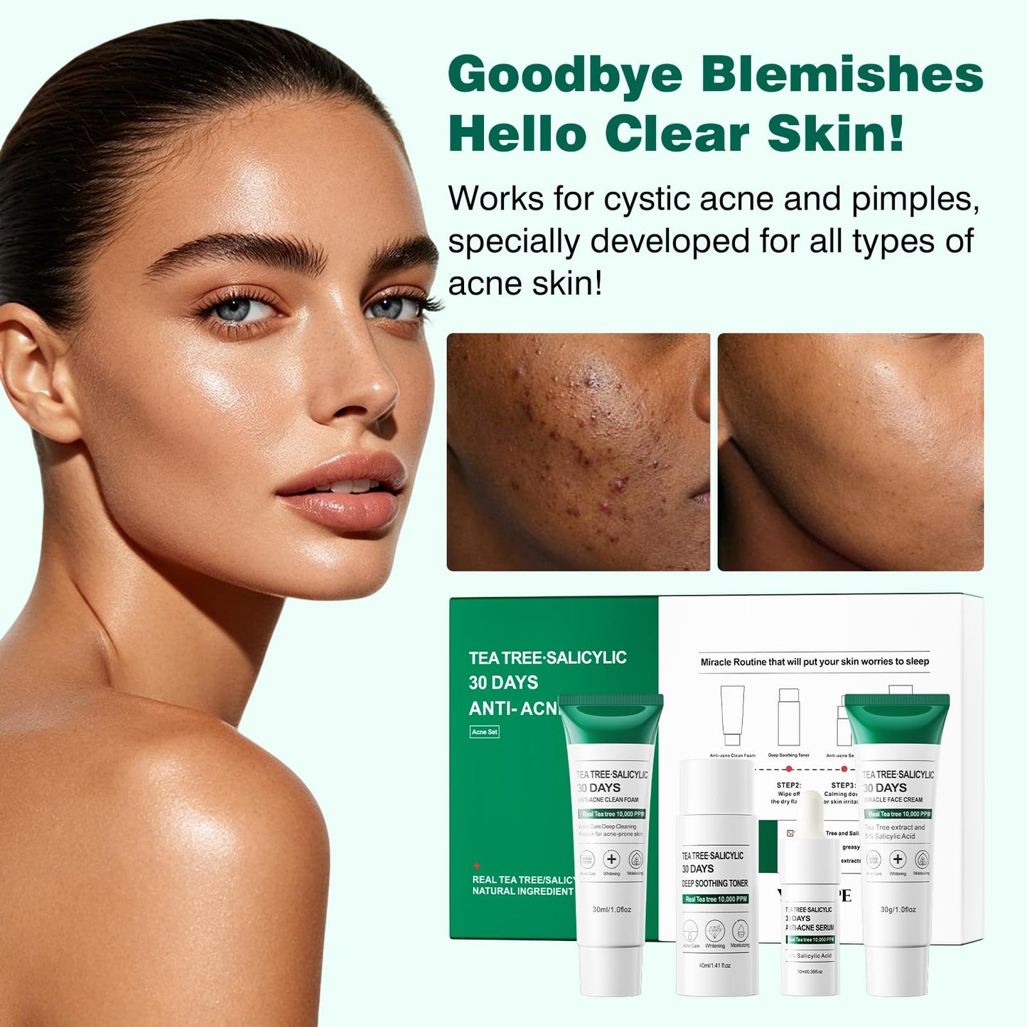 YAFUSIPE Tea Tree Salicylic Acid Facial Skin Care Set & kits, Mini Travel Size Set for Acne Prone Skin - Cystic Hormonal Acne Treatment with Face Cleanser Toner Serum Cream Moisturizer Gifts for Women