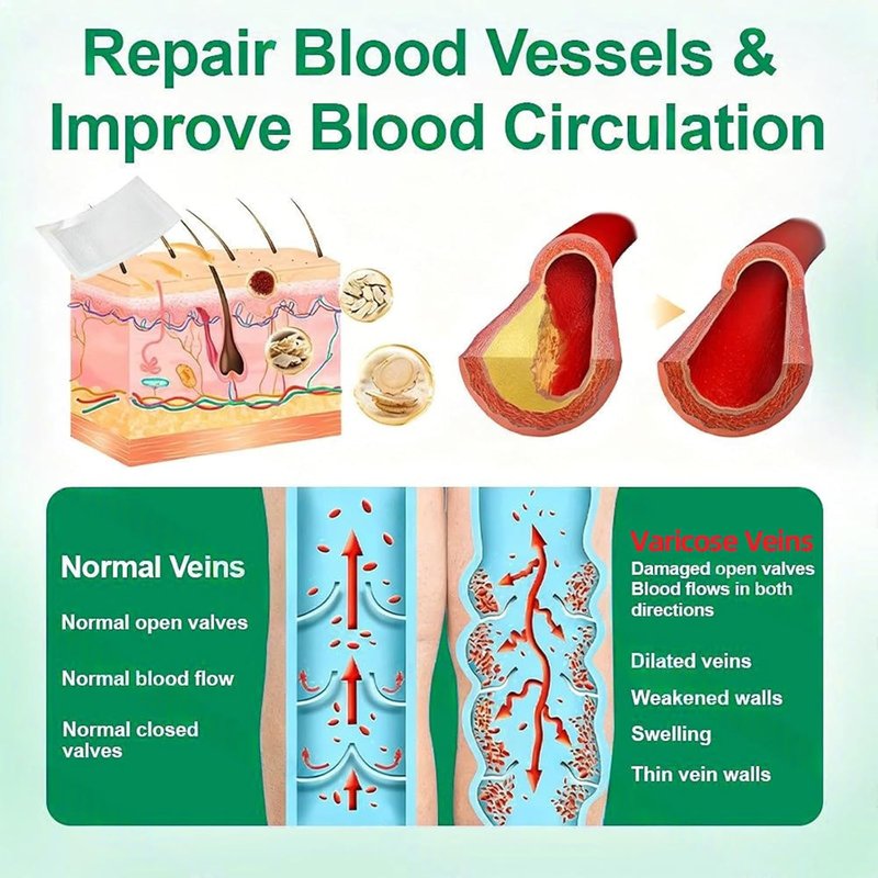 Healrize Vein Target Microdarts Patch - Natural Varicose Vein Treatment for All Skin Types | 1 Box