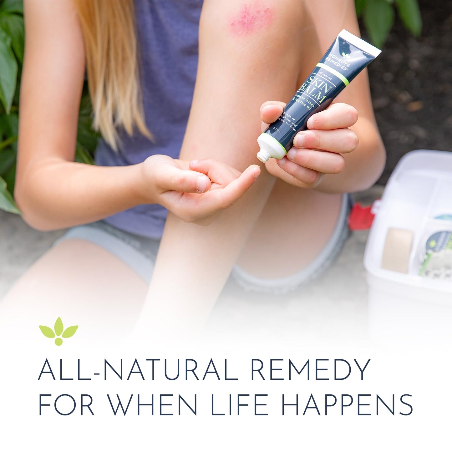 Honeoye Remedies Skin Balm [1 oz / 30 ml] | Manuka Honey [550+ MGO] & Tea Tree Oil Moisturizing Cream for Intensive Repair of Dry Skin, Scrapes, Cuts & More | 100% Natural