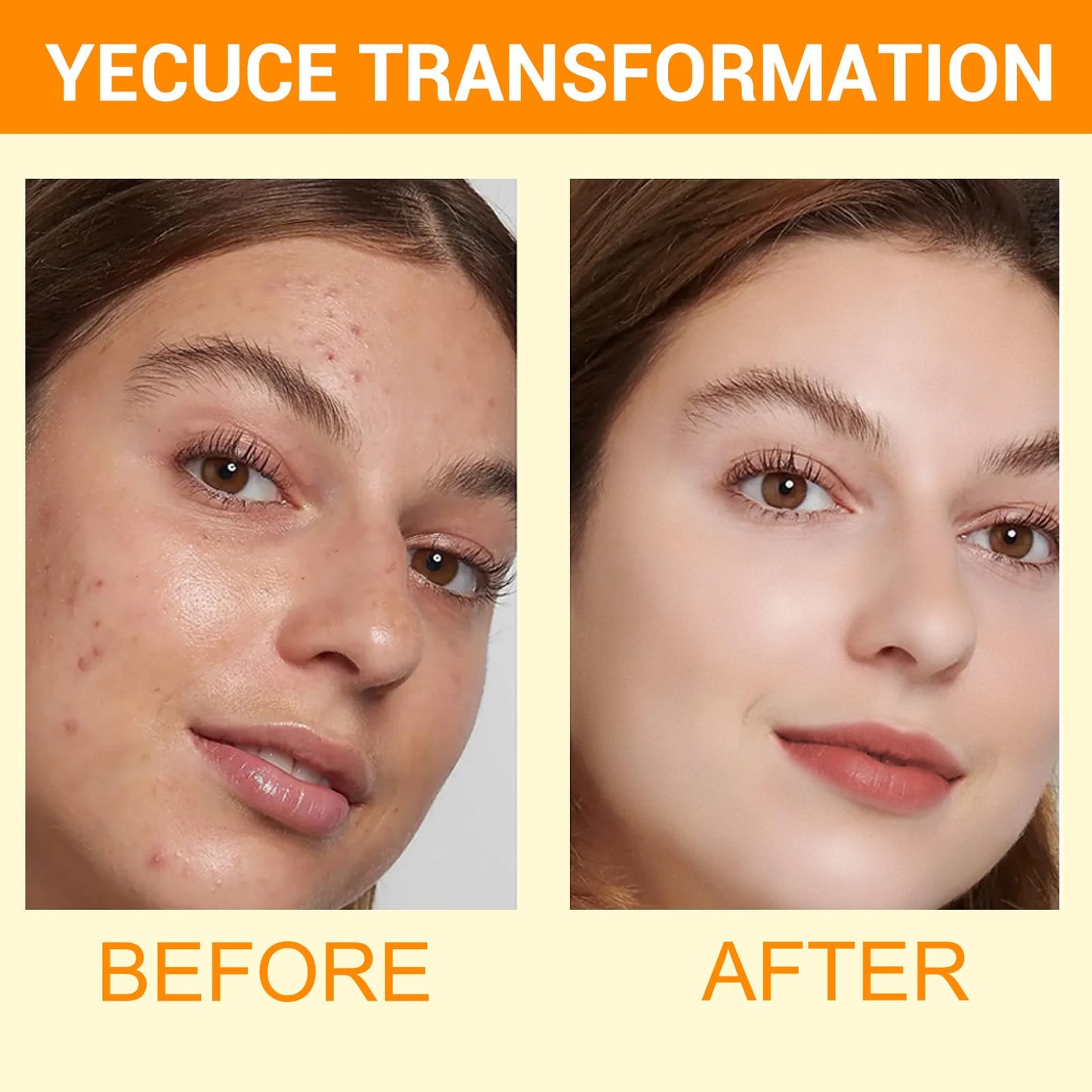 A r b c r n 2 Pack Turmeric Cleansing Mousse,Kojic Acid Facial Cleanser for Fce Wash and Firming Skin,Remove Excess Keratin-Deep Clean Pores 150ML
