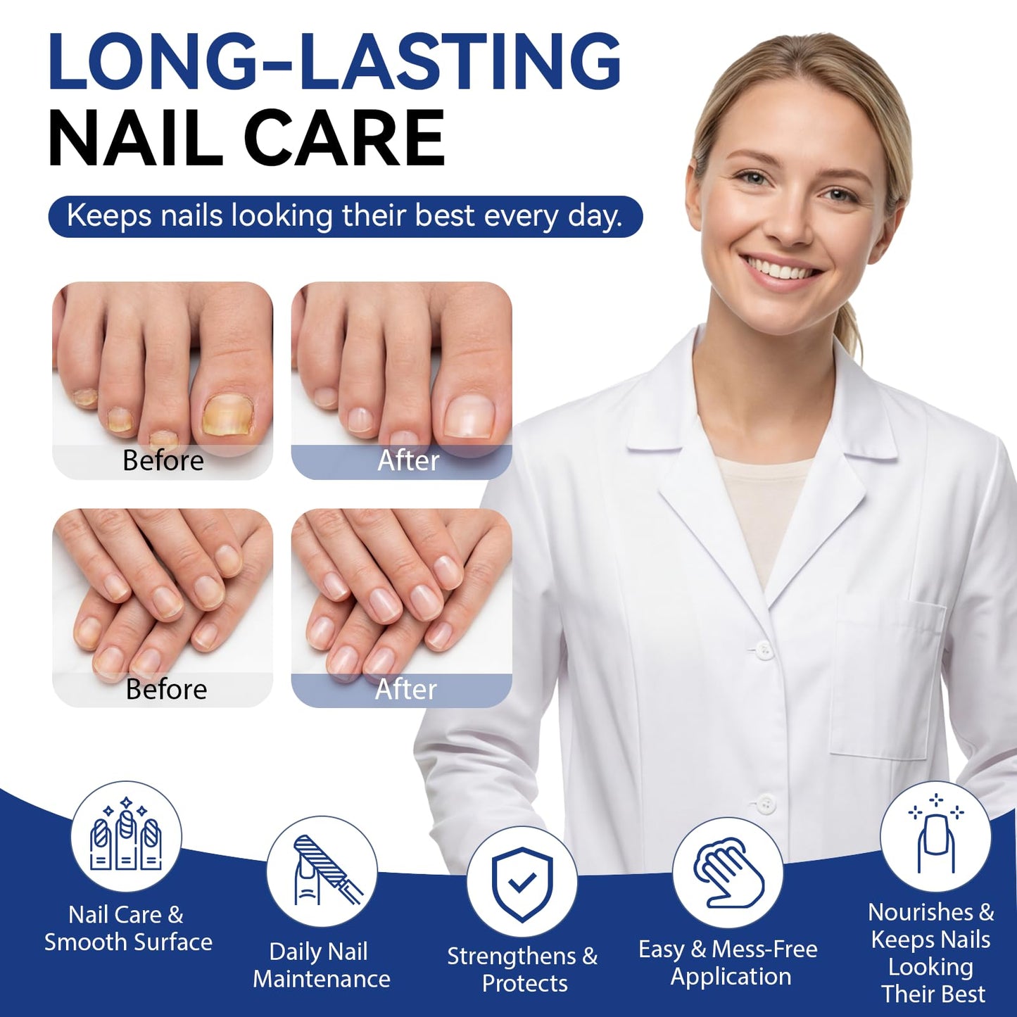 4PCS Nail Care Pen – Daily Nail & Cuticle Care for Improving the Look of Discolored Nails, 4 x 3ML