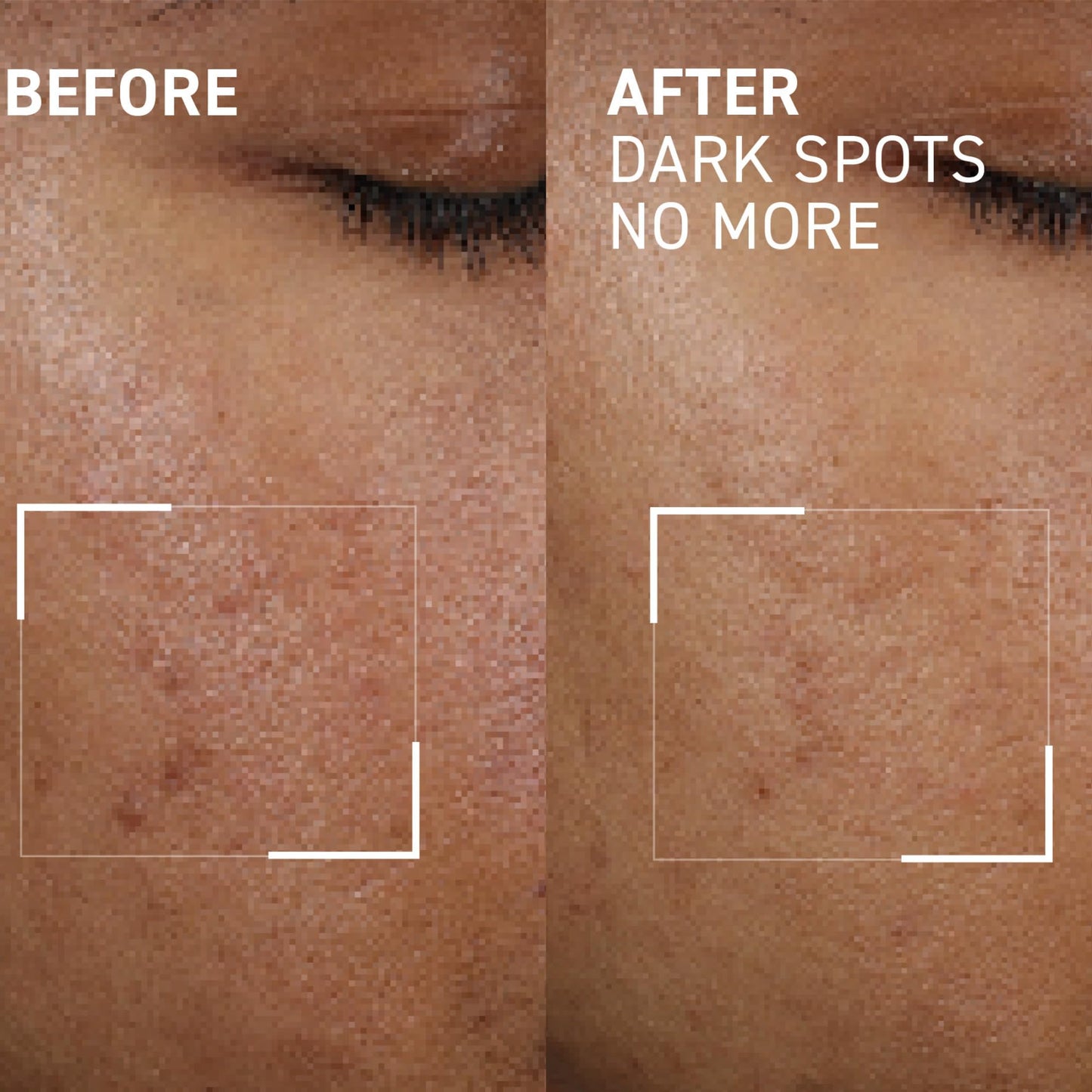Dr. Brandt Bright This Way Dark Spots No More - Reduces Number, Intensity & Size of Pigmented Spots - 0.5 fl oz