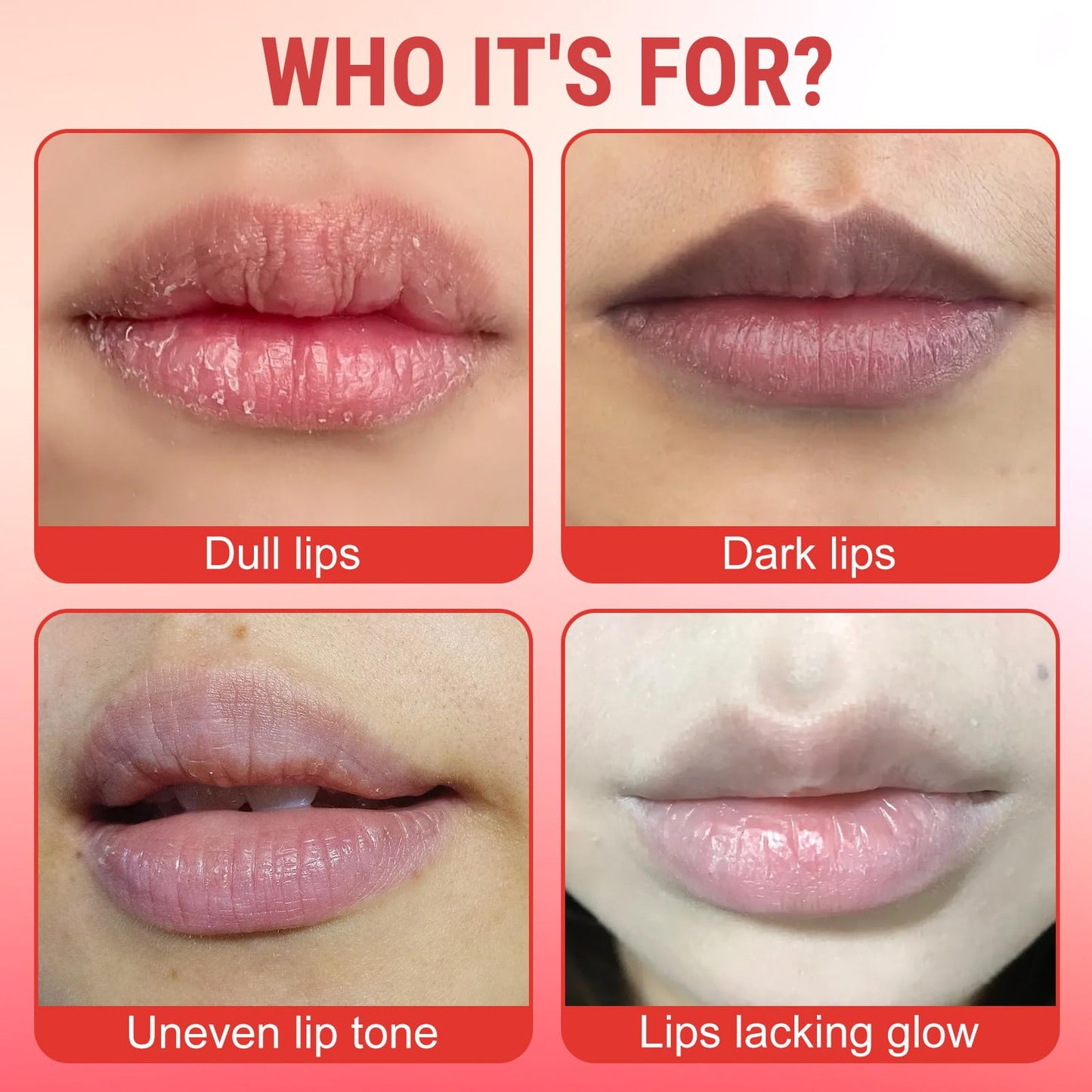 3PCS Lip for Dark Lips, Lip Serum, Dark Lip Treatment Serum for Smokers,Moisturizer Nourishing Essence Lips, Restores Natural Look & Moisture