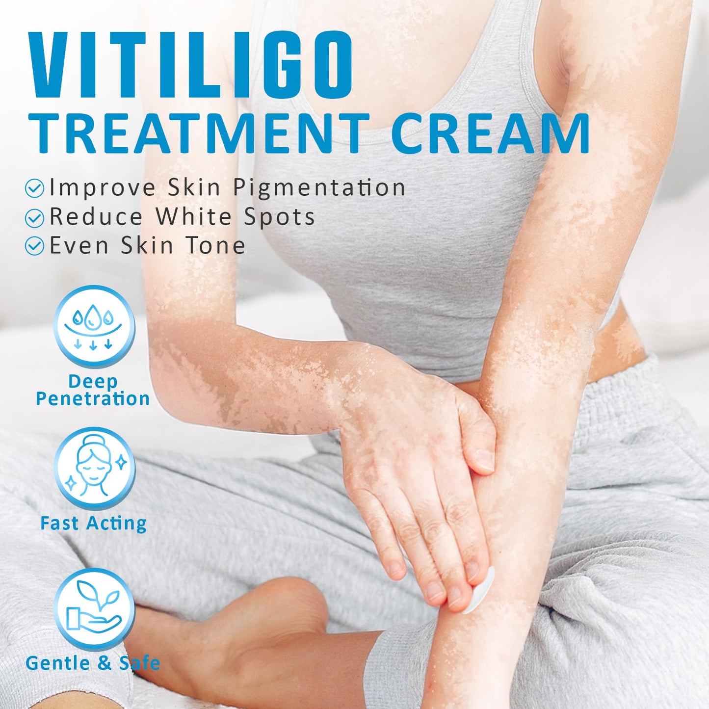 VEXWOLQ Vitiligo Cream, Natural Vitiligo Treatment Cream for Skin Vitiligo-Improve Pigmentation & Fade White Spots, Skin Topical Cream with Gentle Formula for women & men, 20g