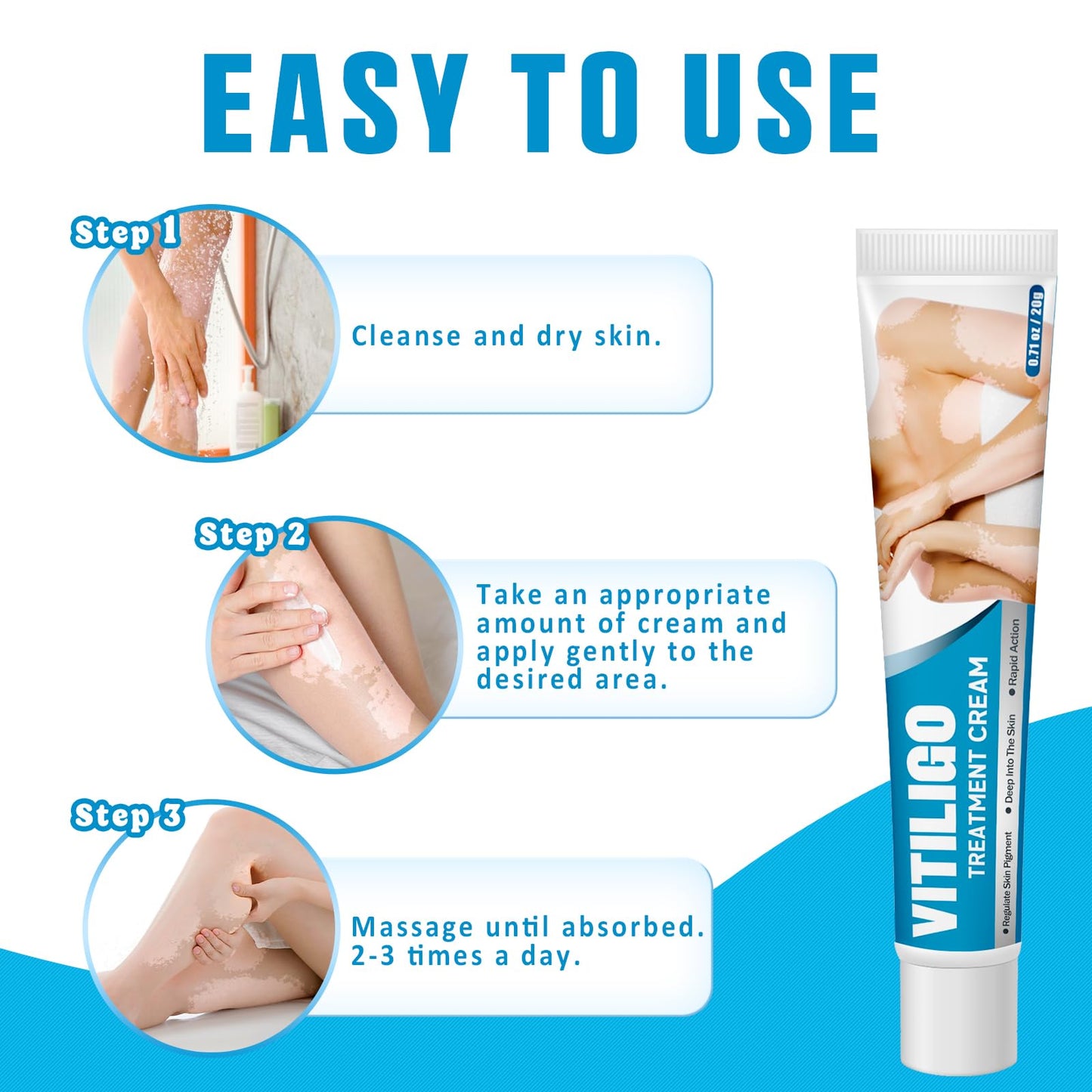 VEXWOLQ Vitiligo Cream, Natural Vitiligo Treatment Cream for Skin Vitiligo-Improve Pigmentation & Fade White Spots, Skin Topical Cream with Gentle Formula for women & men, 20g