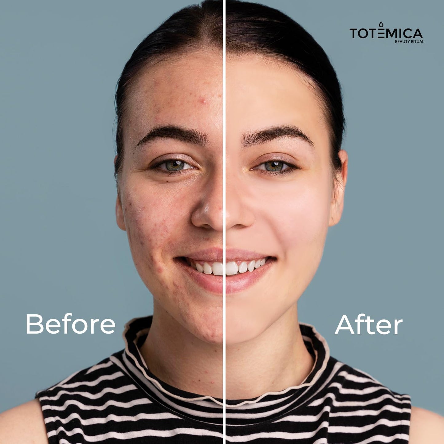 TOTEMICA Face Moisturizer with Niacinamide, Hyaluronic Acid, and Peptides, Wrinkle Filler Anti Aging Serum, Firming Moisturizer for All Skin Types - Vegan, Cruelty-Free (1.69 Fl Oz)
