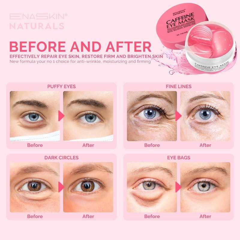 Under Eye Patches Kit: 120 Pcs Retinol & Golden Gel Eye Mask for Dark Circles, Puffiness and Wrinkles - Day & Night Skin Treatment Pads with Niacinamide, Collagen, Hyaluronic Acid & Vitamin C (2 Pack)
