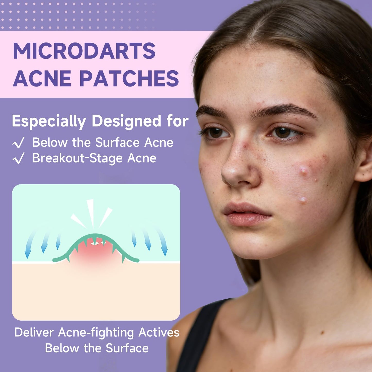 TEAWOO 36-Count Microdart Acne Patches, Cute Pink Round-shaped, Hydrocolloid Pimple Patches with Salicylic Acid & Madecossoside, Microdart Zit Patches for Deep Blemishes & Early Stage Acne (Patented)