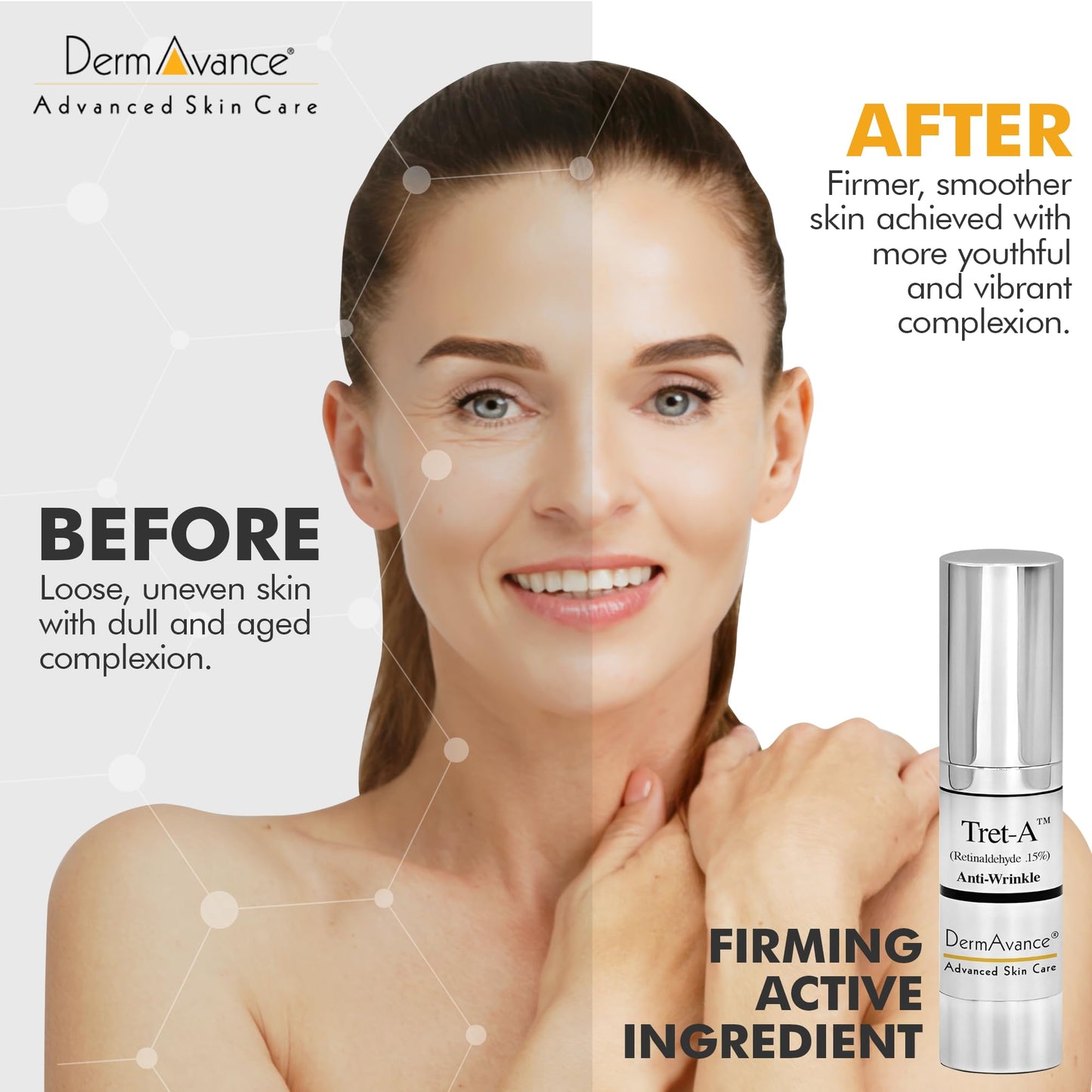 DermAvance Tret-A Retinaldehyde 0.15% Strongest Anti-Aging Face Cream Routine for Women – Anti-Aging Face Moisturizer & Wrinkle Face Cream – Moisturizing Routine – 15ml