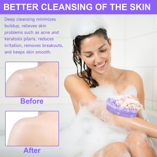 Metene Silicone Exfoliating Body Scrubber with Loop, Body Scrubber for Men and Women, Silicone Loofah for Shower, Soft Silicone Body Scrubber for Shower and Bath Skincare Routine (Purple)