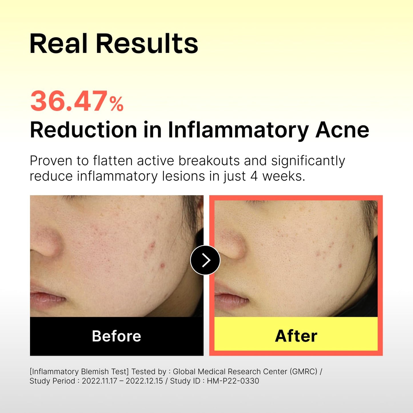 Celladix Sebum Rebalancing Rx 131 Ampoule | Pore Clearing Serum | Tighten Enlarged Pores | Repair Skin Barrier | Rapid Soothing for Daily Use | Oily & Combination Skin| 1.01 Fl Oz