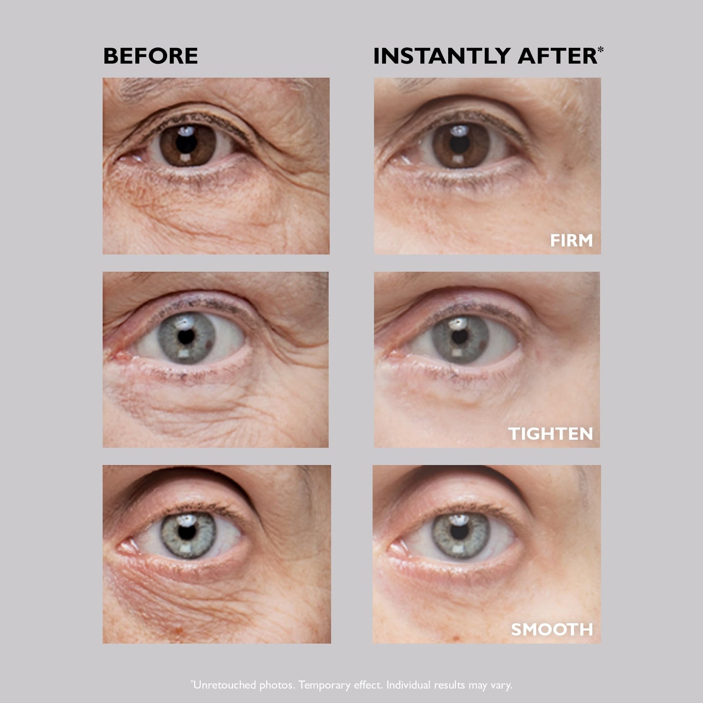 Peter Thomas Roth | Instant FIRMx® Eye Temporary Eye Tightener