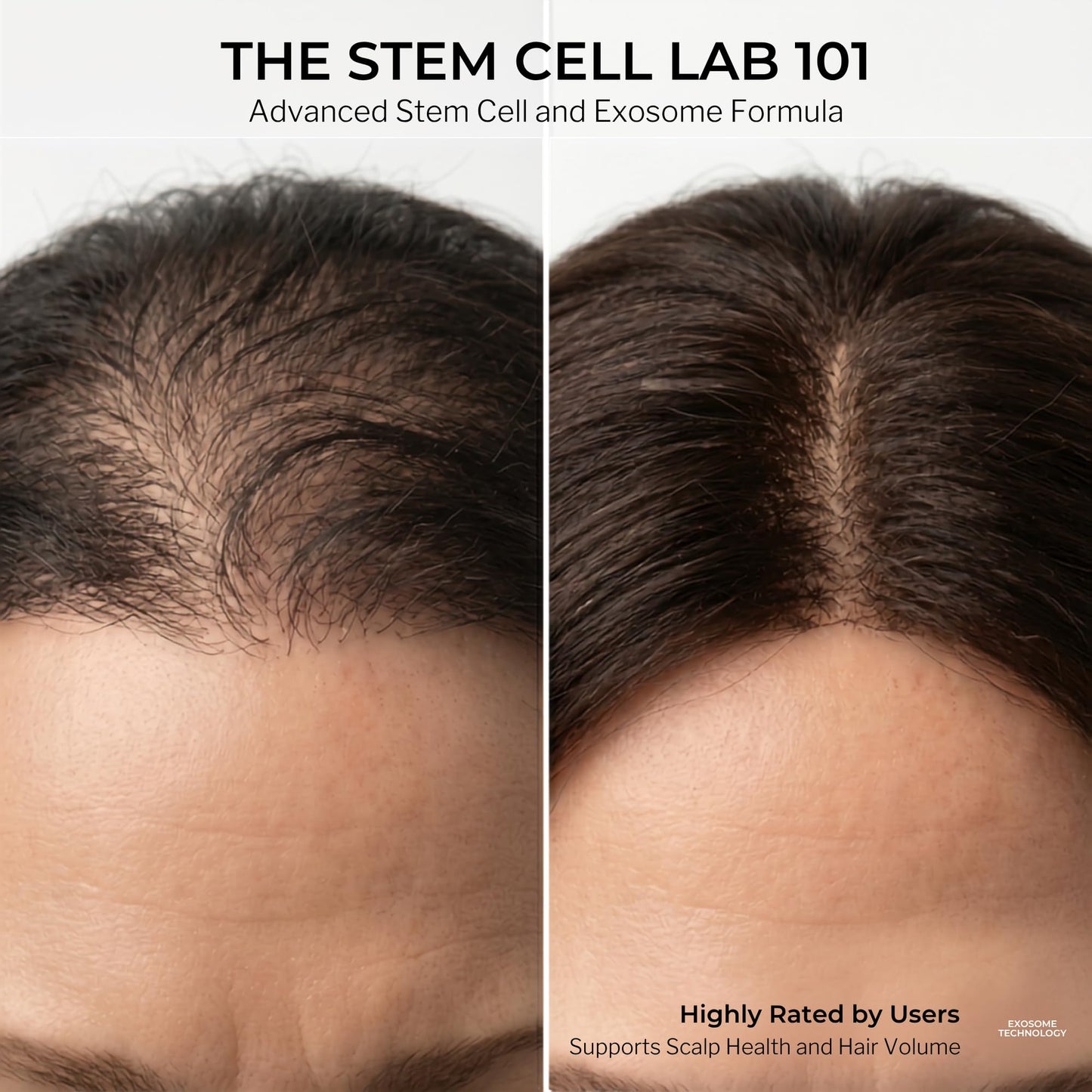 The Stem Cell Lab Hair Serum, Exosome Enriched, 50ml