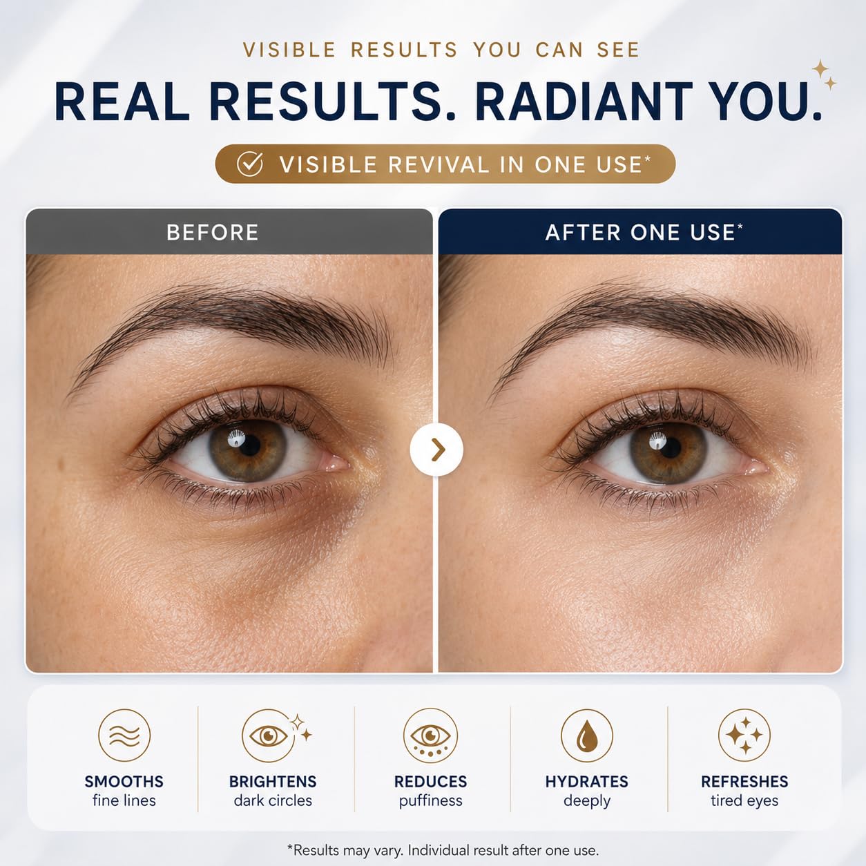 AVER Under Eye Patches for Anti-Wrinkle Treatment for Dark Circles, Lifting, Firming & Anti-Aging | Peptide, Collagen, Hyaluronic Acid, Panthenol & Niacinamide | Hydrates, Brightens & Firms | 3 Pairs