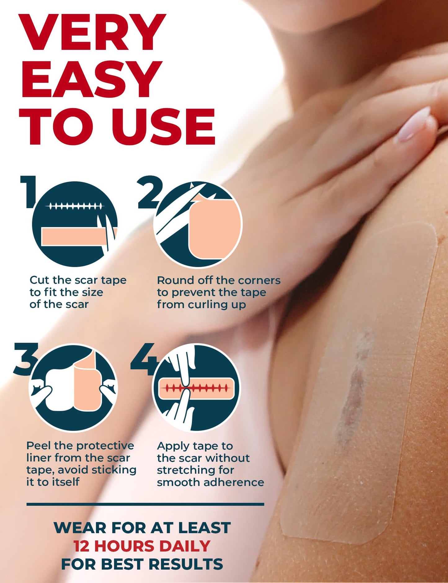 Medical Grade Silicone Scar Tape - 1.6”x70” - Effective Removal of Surgical, Keloid, C-Section, Tummy Tuck, Hypertrophic and Acne Scars - Easy to Use Treatment - Reusable Silicone Scar Sheets