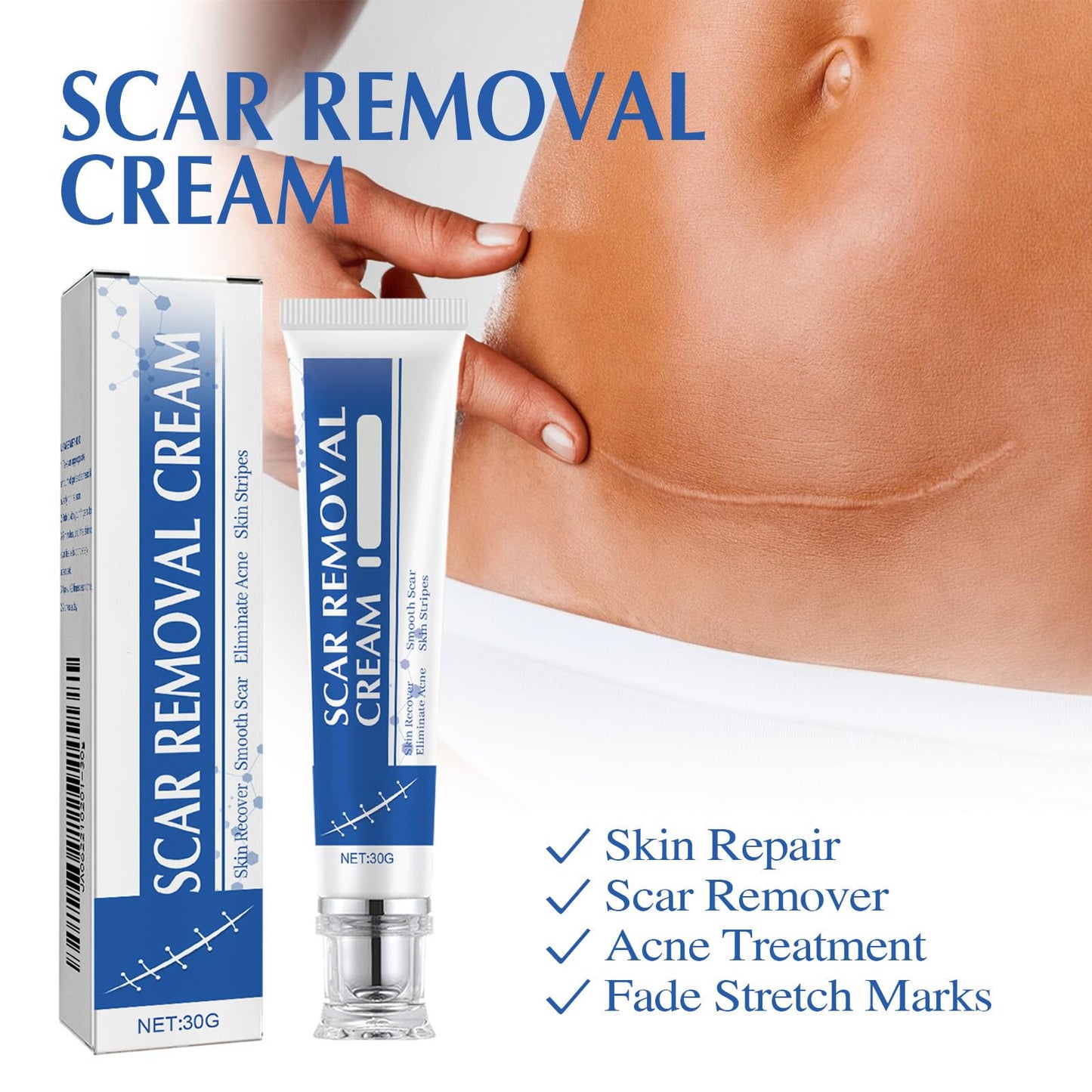 Scar Cream,Scar Removal Cream,Silicone Scar Gel,Scar Silicone Gel,Scar Gel,Scar Cream for Surgical Scars, Stretch Marks and Keloid Bump (1pcs)