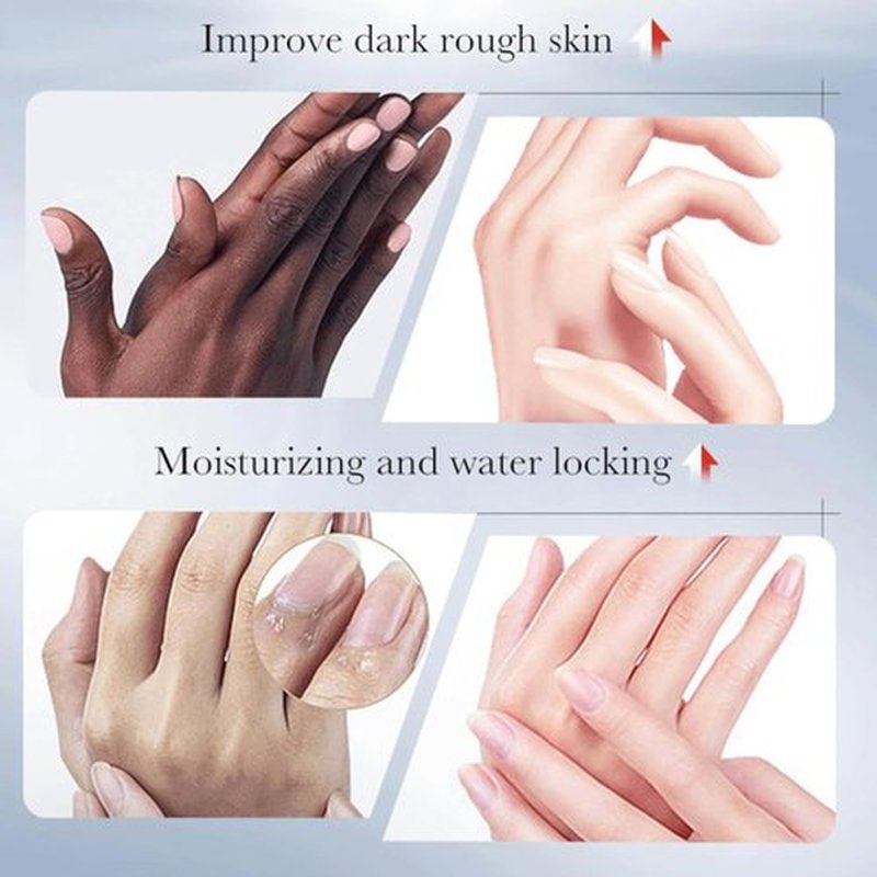 Sadoer Kojic Acid Hand Cream,Kojic Acid Hand Cream,Sadoer Kojic Acid Cream,Kojic Acid Face Cream (Hand+Face Cream, 30g)