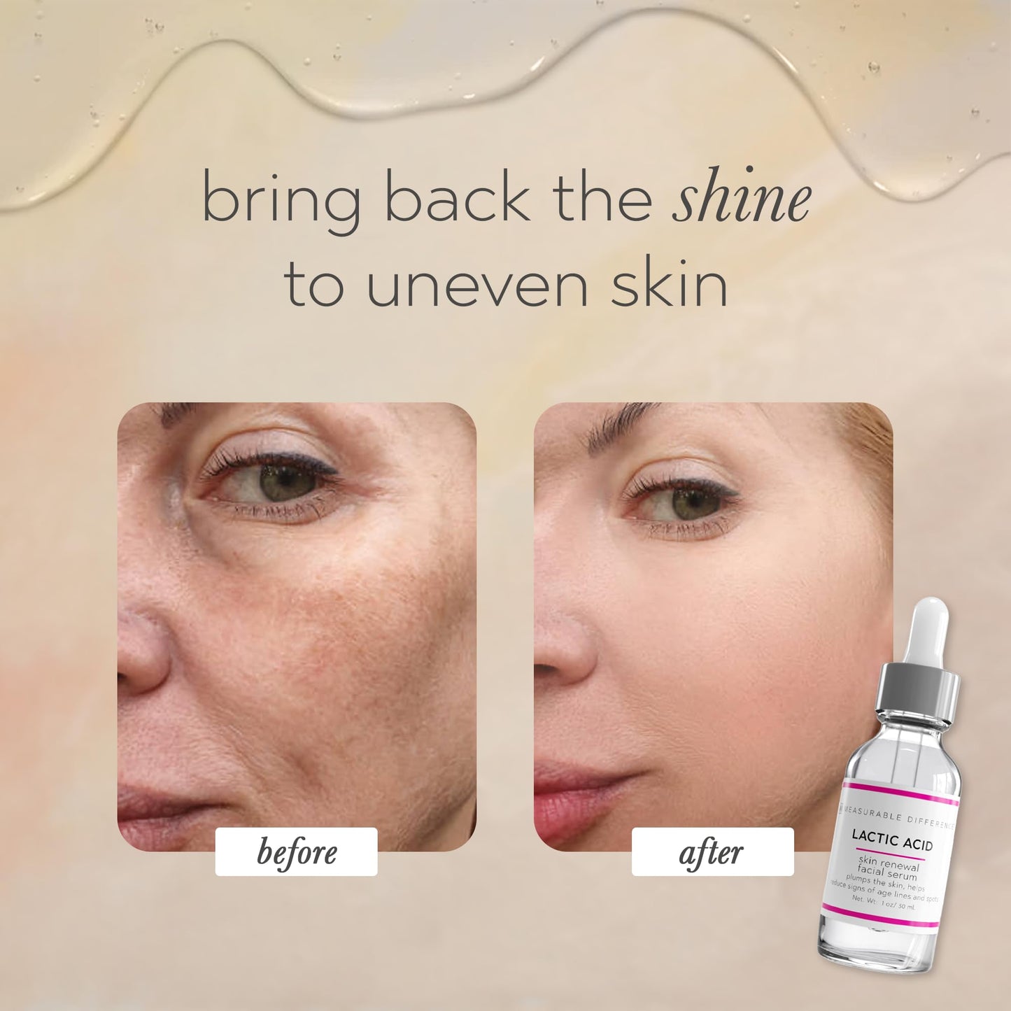 Measurable Difference Lactic Acid Face Serum, 1 oz - Exfoliate, Strengthen, and Hydrate Skin for Daily Protective Barrier