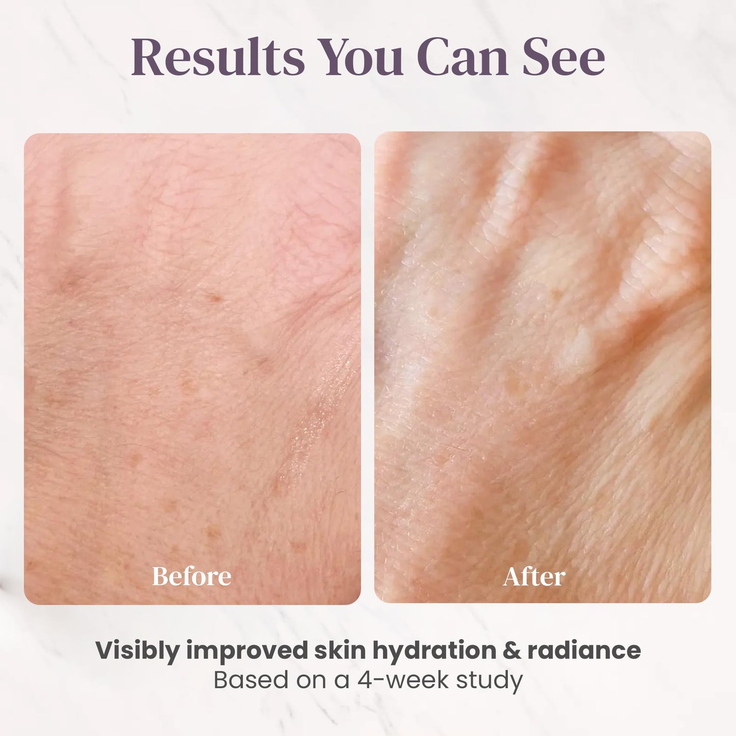 IKI Skincare - Gaman Body Repair Balm - Intensely Nourishes Dry Skin - Repairs Damaged Skin Barrier - Soothes Irritation & Itching - Locks In 24-Hour Moisture - With Natural Oils & Vitamin E - 120ml