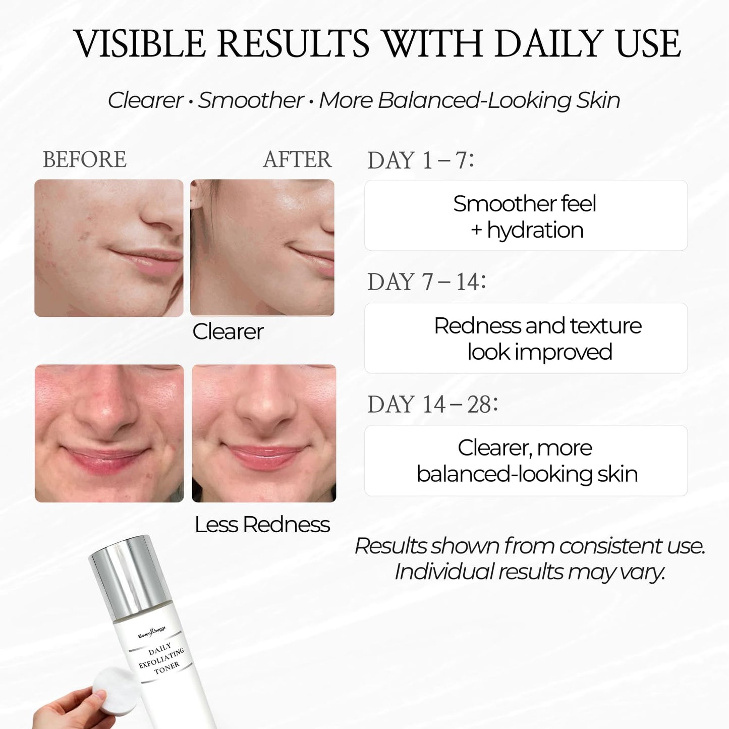 Daily Exfoliating Toner with AHA & BHA – Gentle AM/PM Pore Refining Liquid Exfoliant for Men & Women – Clears Pores, Smooths Texture, Hydrates Skin – Unscented, Non-Irritating Formula