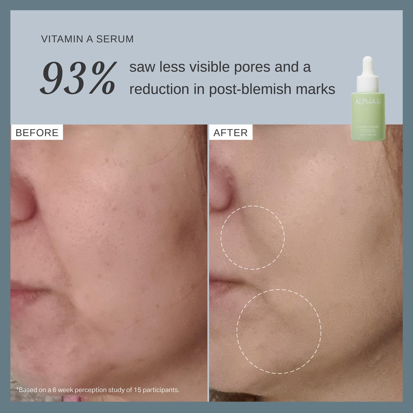 Alpha-H Vitamin A Serum With 0.5% Retinol - Gentle Night Renewal For Smoother, Brighter-Looking Complexion - Promotes Improved Texture, Elasticity, And Reduces Appearance of Visible Lines