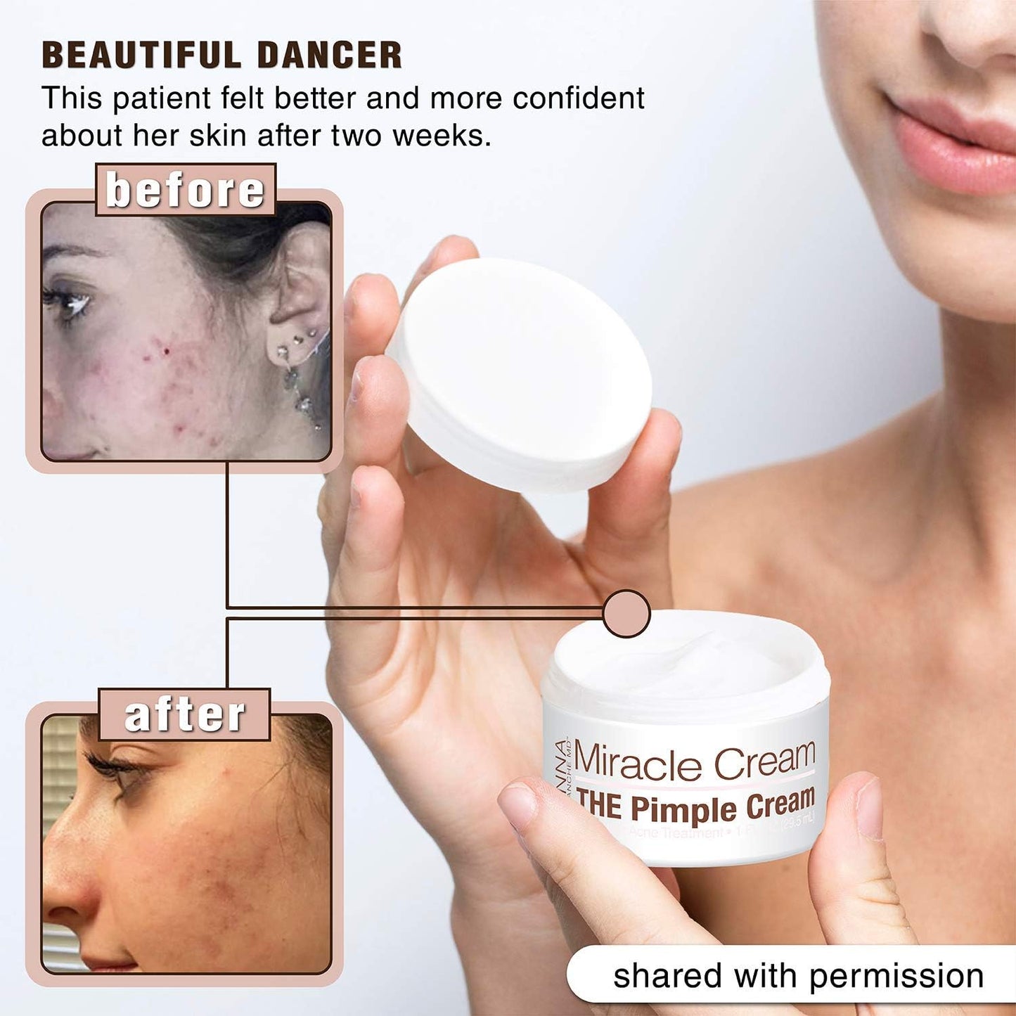 Anna Guanche MD Miracle Cream - Acne Treatment that Quickly Reduces Pimples & Redness .5mL