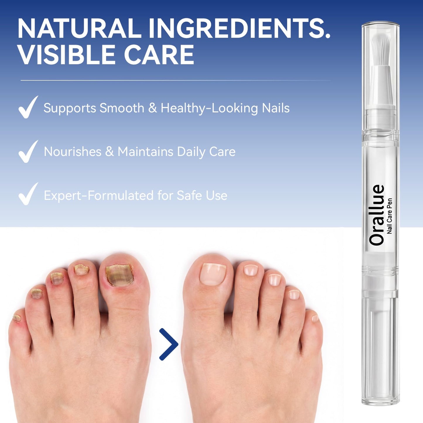 4PCS Nail Care Pen – Daily Nail & Cuticle Care for Improving the Look of Discolored Nails, 4 x 3ML