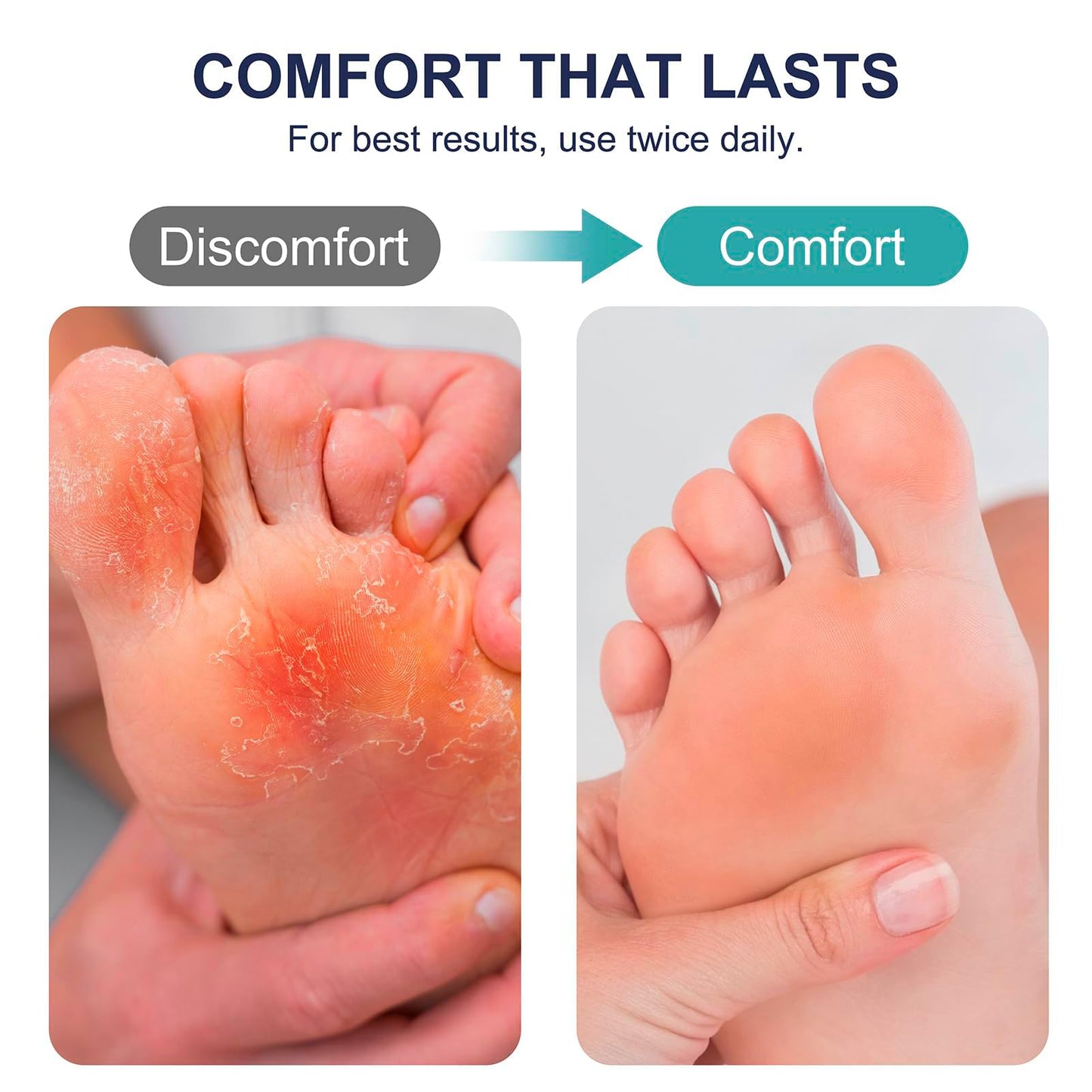 Kerova Antifungal Cream for Athlete’s Foot, Jock Itch & Ringworm – 1% Clotrimazole Antifungal Cream, Ringworm Treatment for Humans, Relieves Burning, Itching, Scaling & Cracking (3.5 Ounce)