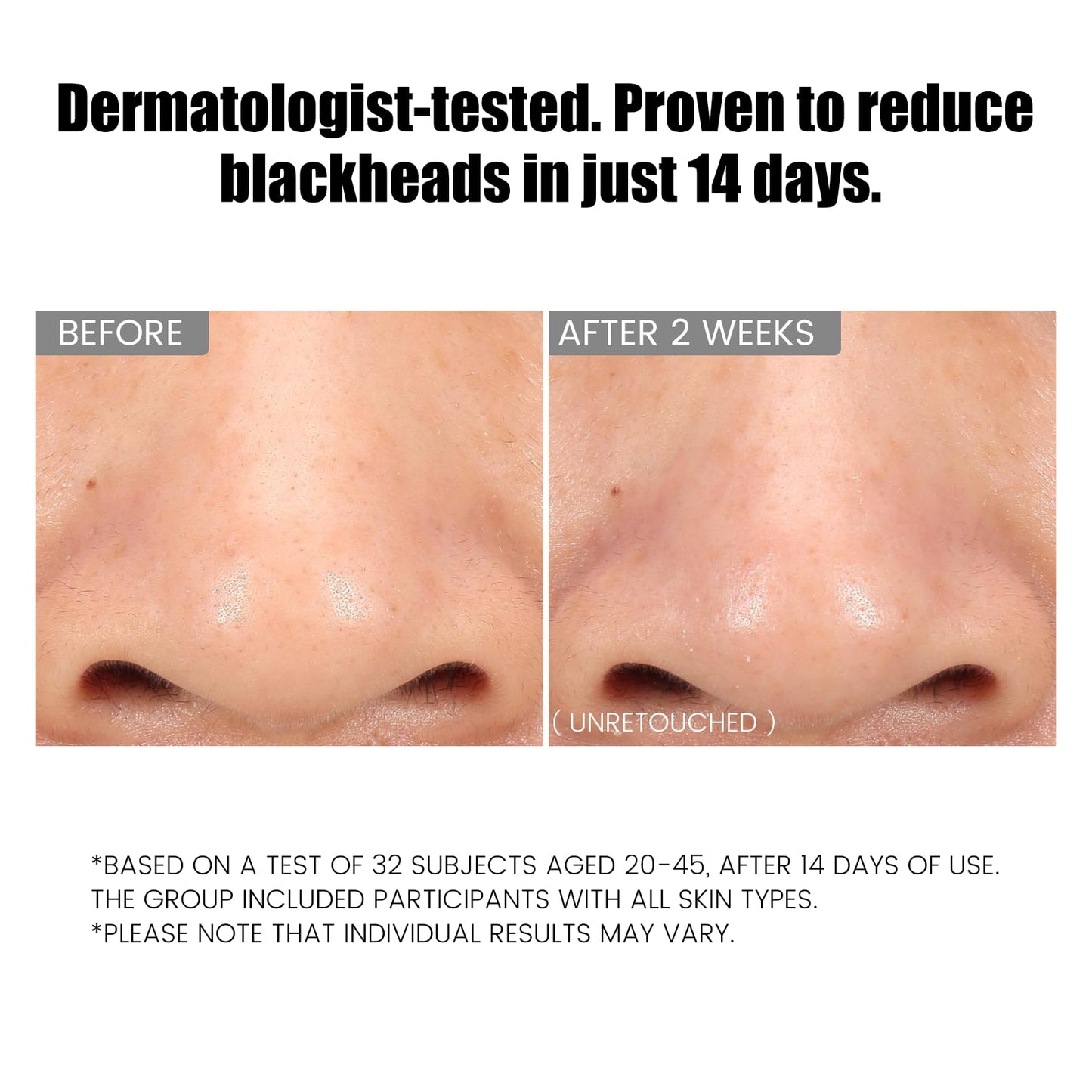 ConfidMiss Dual-Tube Refreshing Facial Cleanser, with Double Micro-Fine White Clay Centella Asiatica Pore Cleaning Blackhead Sunscreen Remover Daily Face Amino Acid Cleanser For Oily Skin 1PC